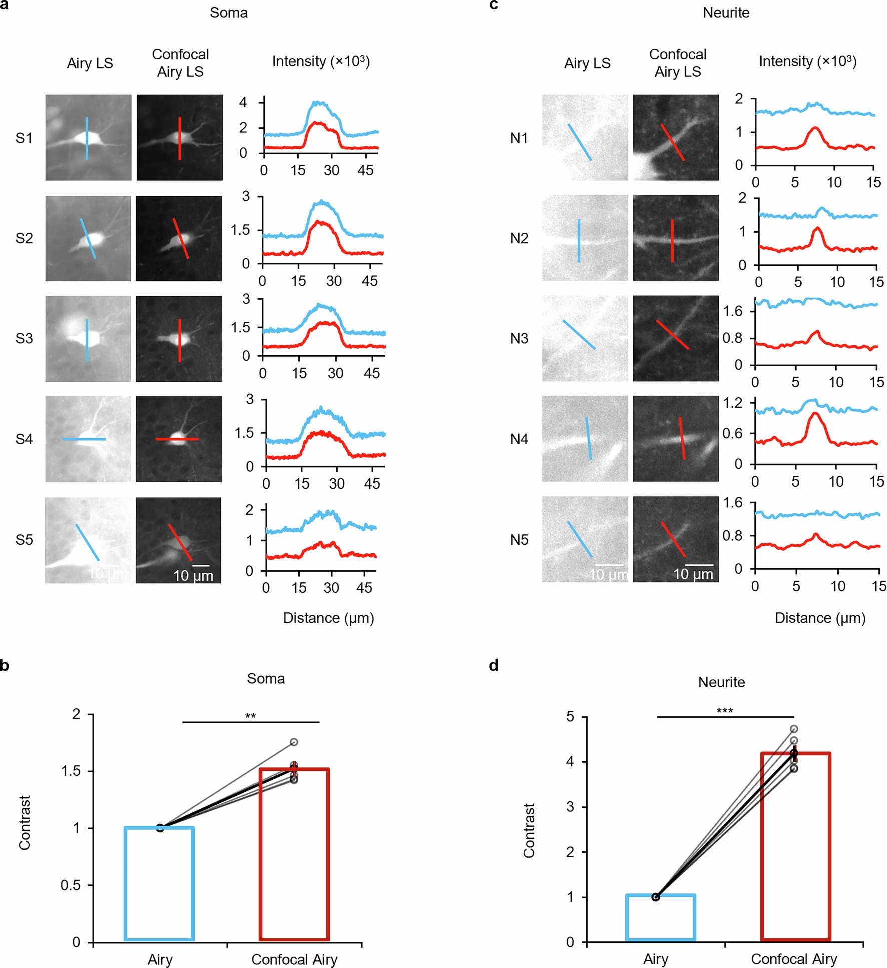 Extended Data Fig. 6: Quantitative comparison with Slit Confocal Airy LS and standard Airy LS in different signal locations.