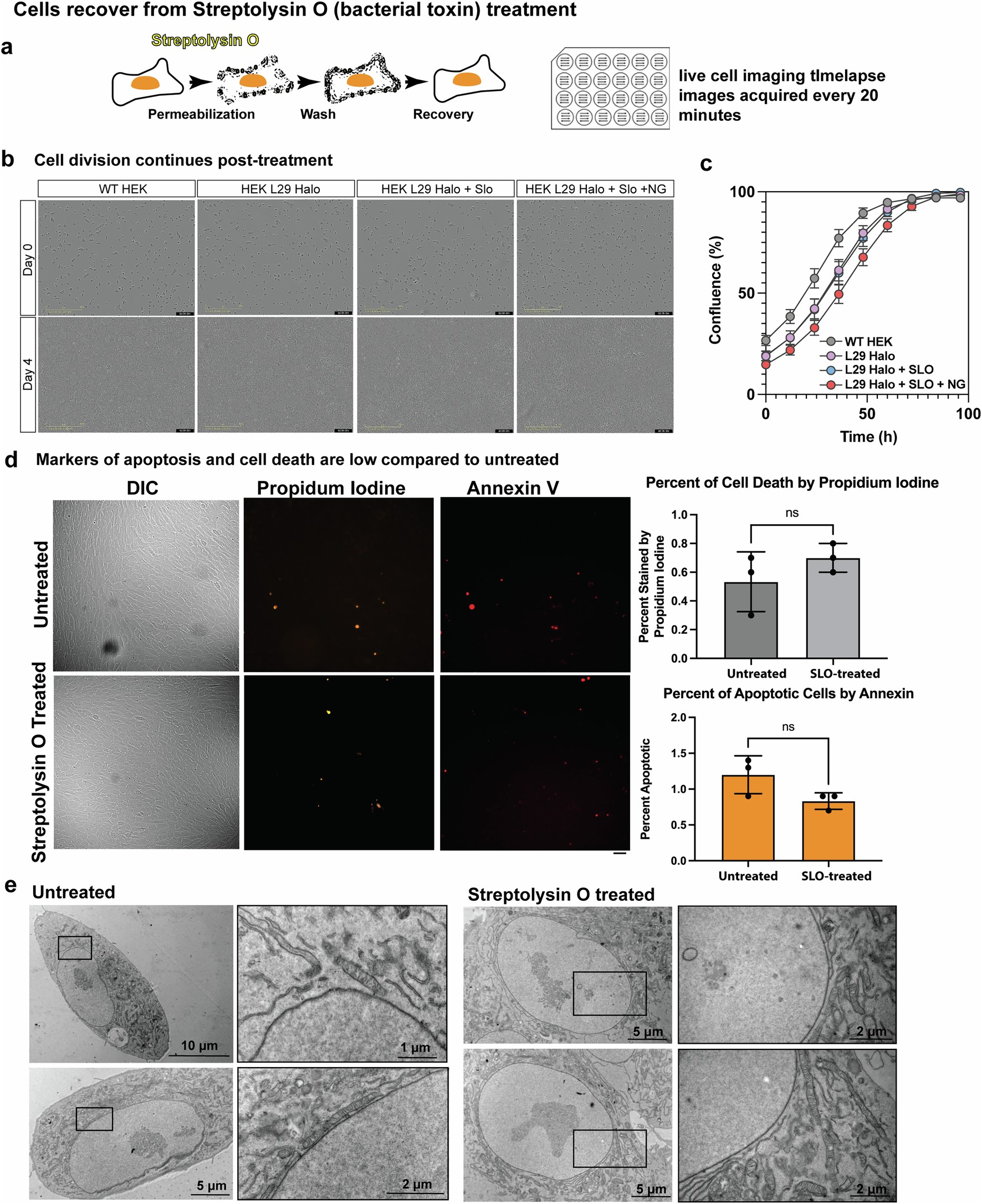 Extended Data Fig. 2: Cells recover from Streptolysin O (SLO) treatment.