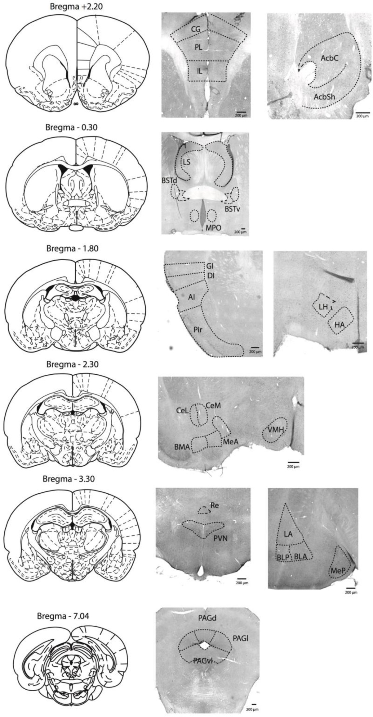 Supplementary Figure 7: Representative examples of c-Fos immunohistochemistry and regions of interest.