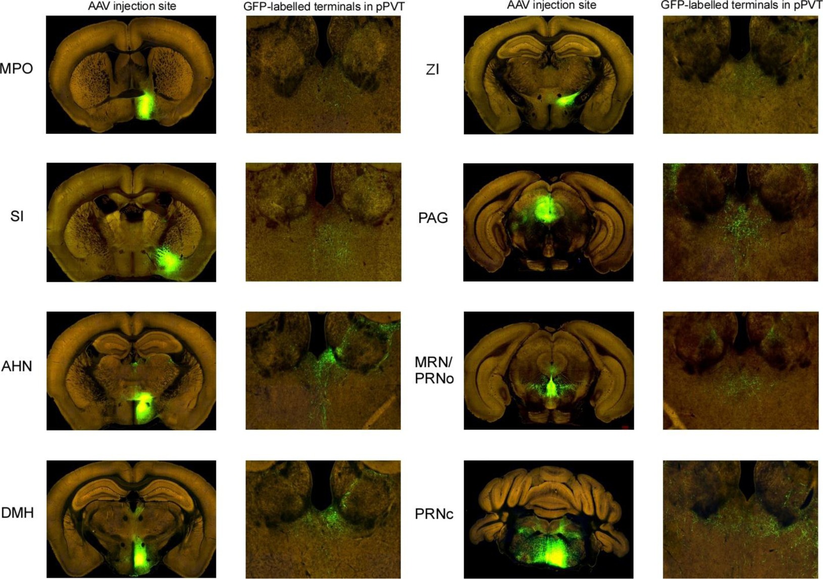 Supplementary Figure 1: Inhibitory projections to the pPVT.