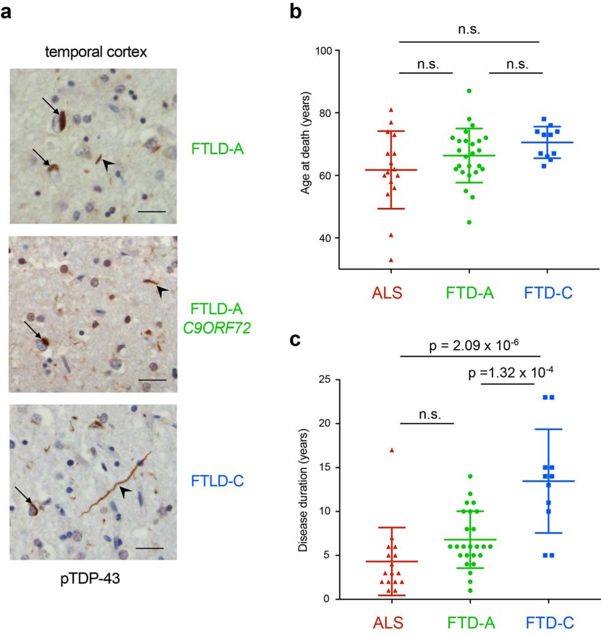 Supplementary Figure 1: Characteristics of disease subtypes and correlation to disease duration.