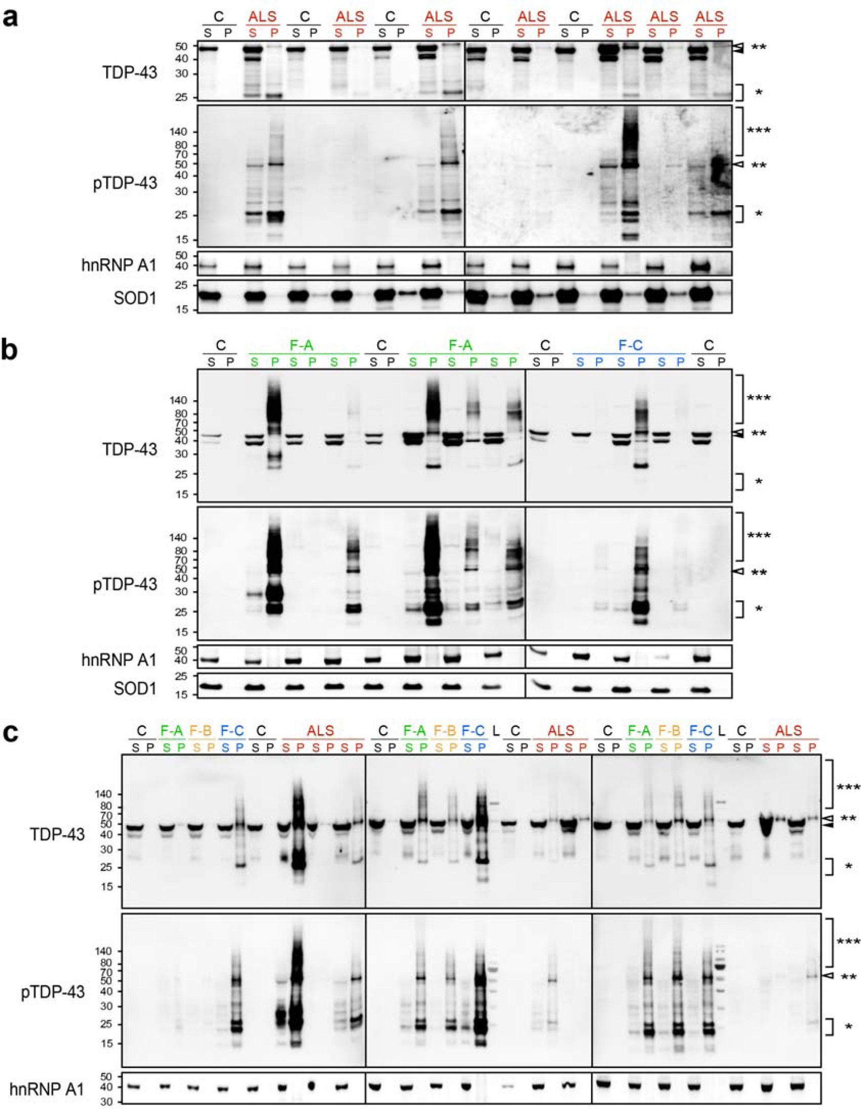 Supplementary Figure 3: Immunoblots of SarkoSpin fractions from all groups of patients show consistent isolation of pTDP-43.