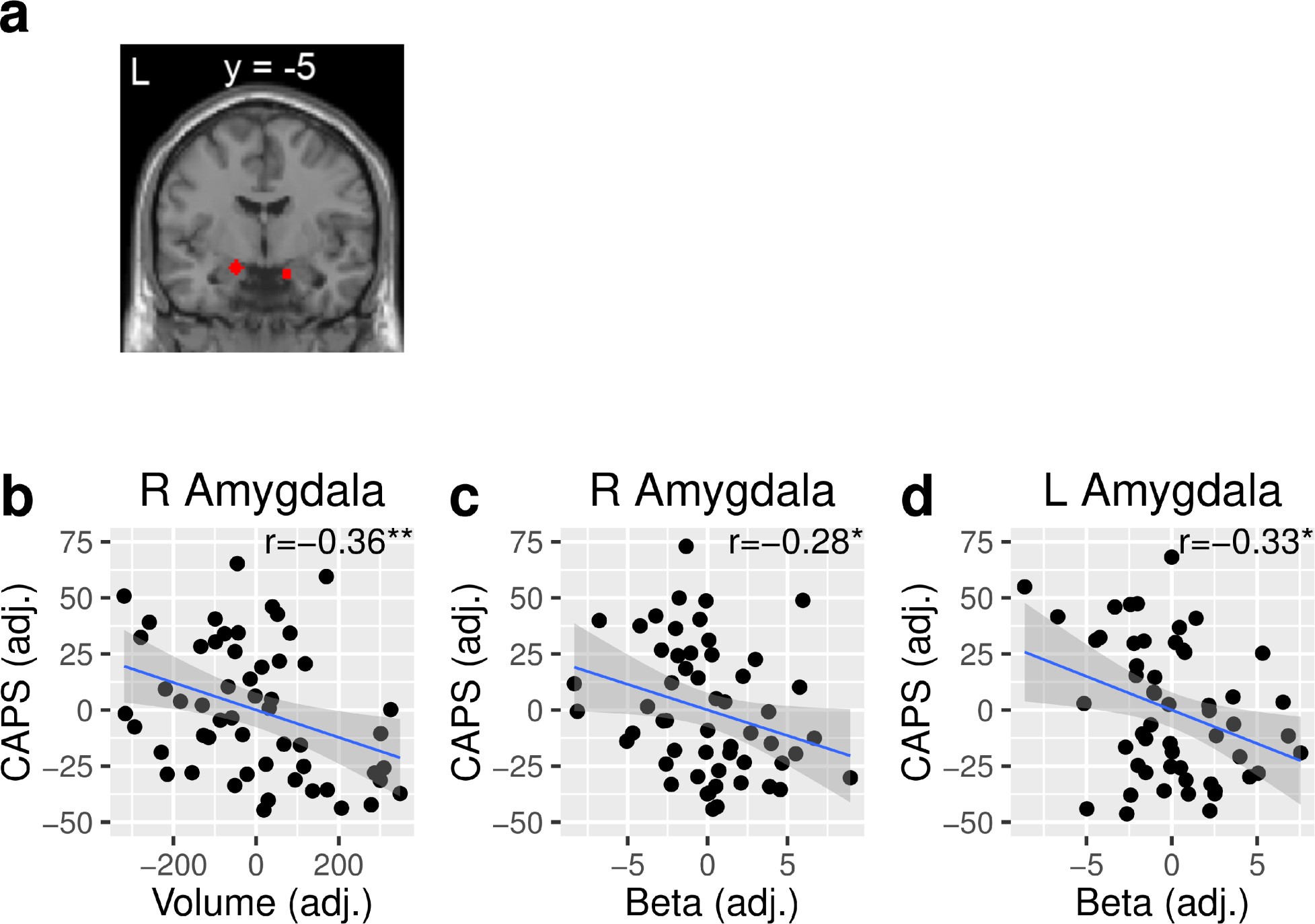 Supplementary Figure 7: Amygdala structure and value computation contribute to PTSD symptoms using a Rescorla–Wagner model.