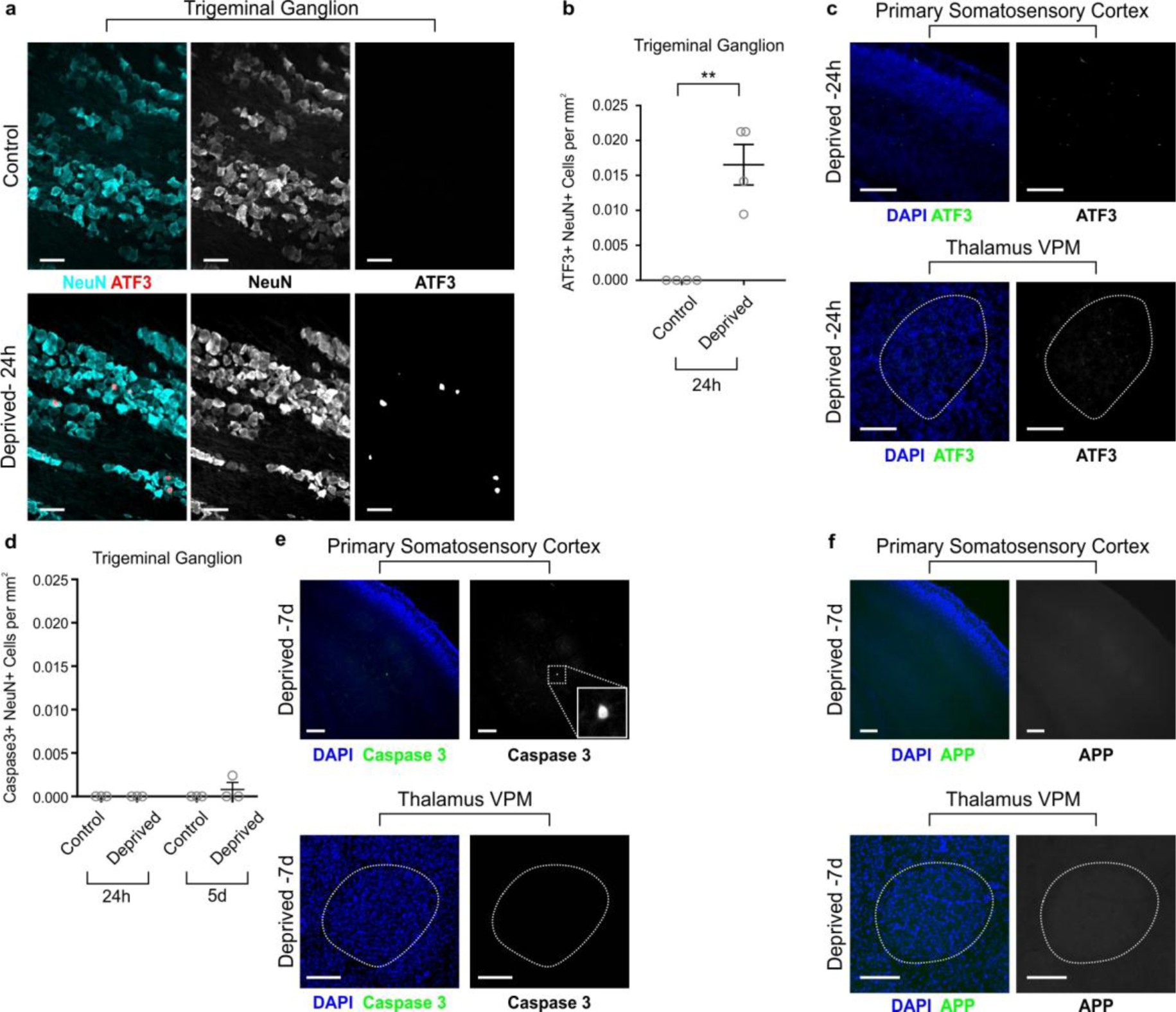 Supplementary Figure 2: Effects of whisker lesioning at P4 on cell death, axon degeneration, and cell stress in the barrel cortex circuit.