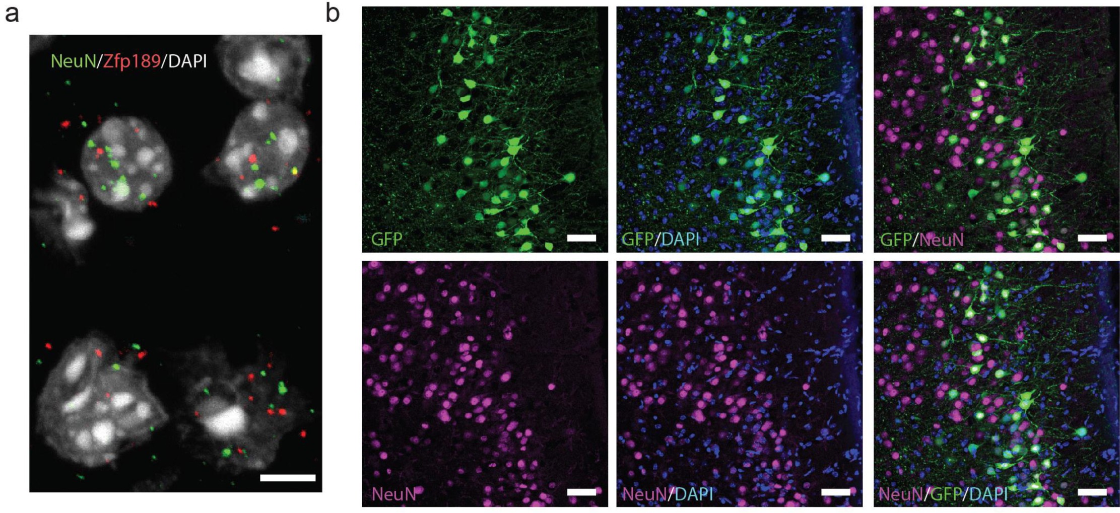 Supplementary Figure 3: Neuronal enrichment of Zfp189 and HSV infection.