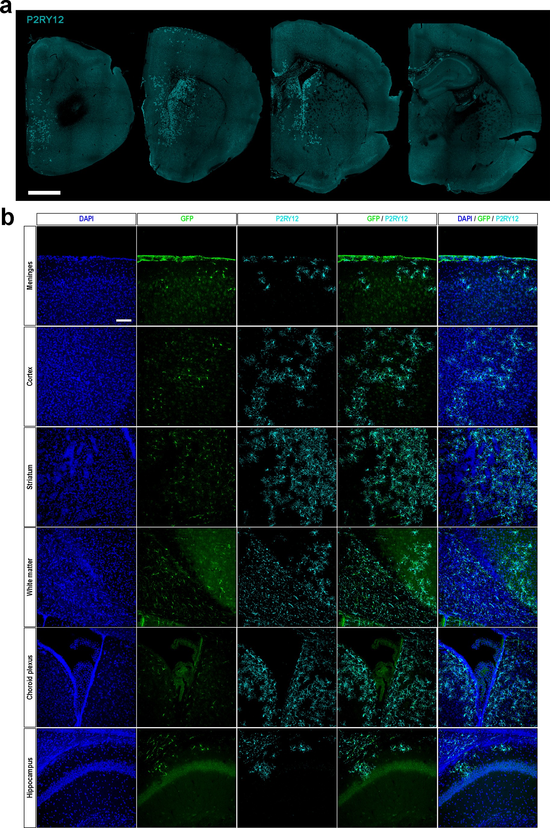 Extended Data Fig. 2: H9-microglia showed a widespread distribution across multiple areas of the brain.