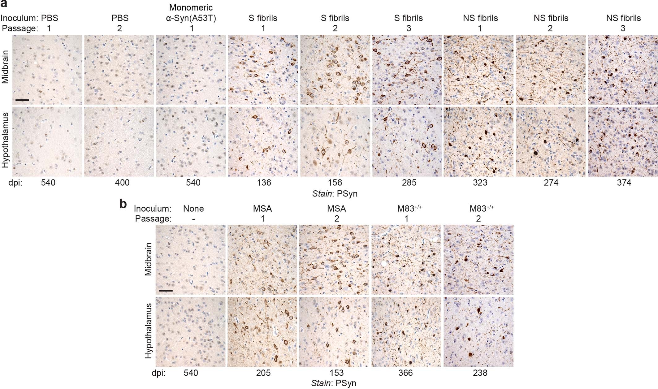 Extended Data Fig. 5: Phosphorylated α-syn (PSyn) deposition in the midbrain and hypothalamus of TgM83 mice injected with various α-syn strains.
