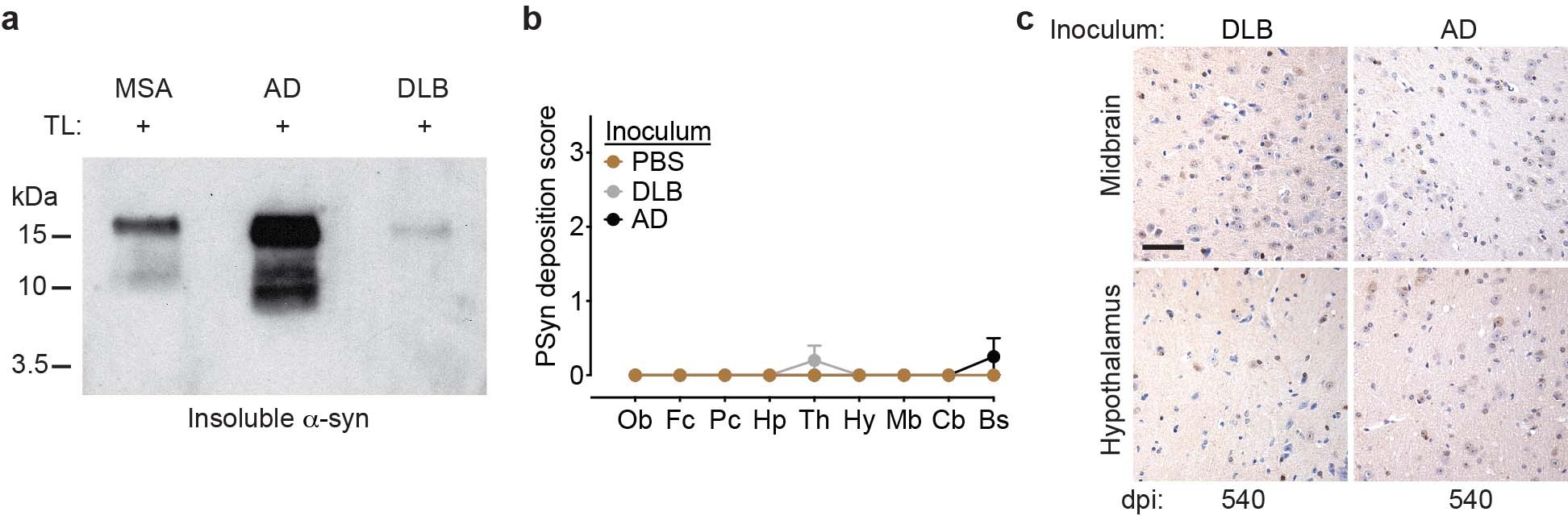 Extended Data Fig. 10: Absence of PSyn pathology in TgM83 mice inoculated with brain extract from a DLB patient or an AD patient with concomitant α-syn deposition.