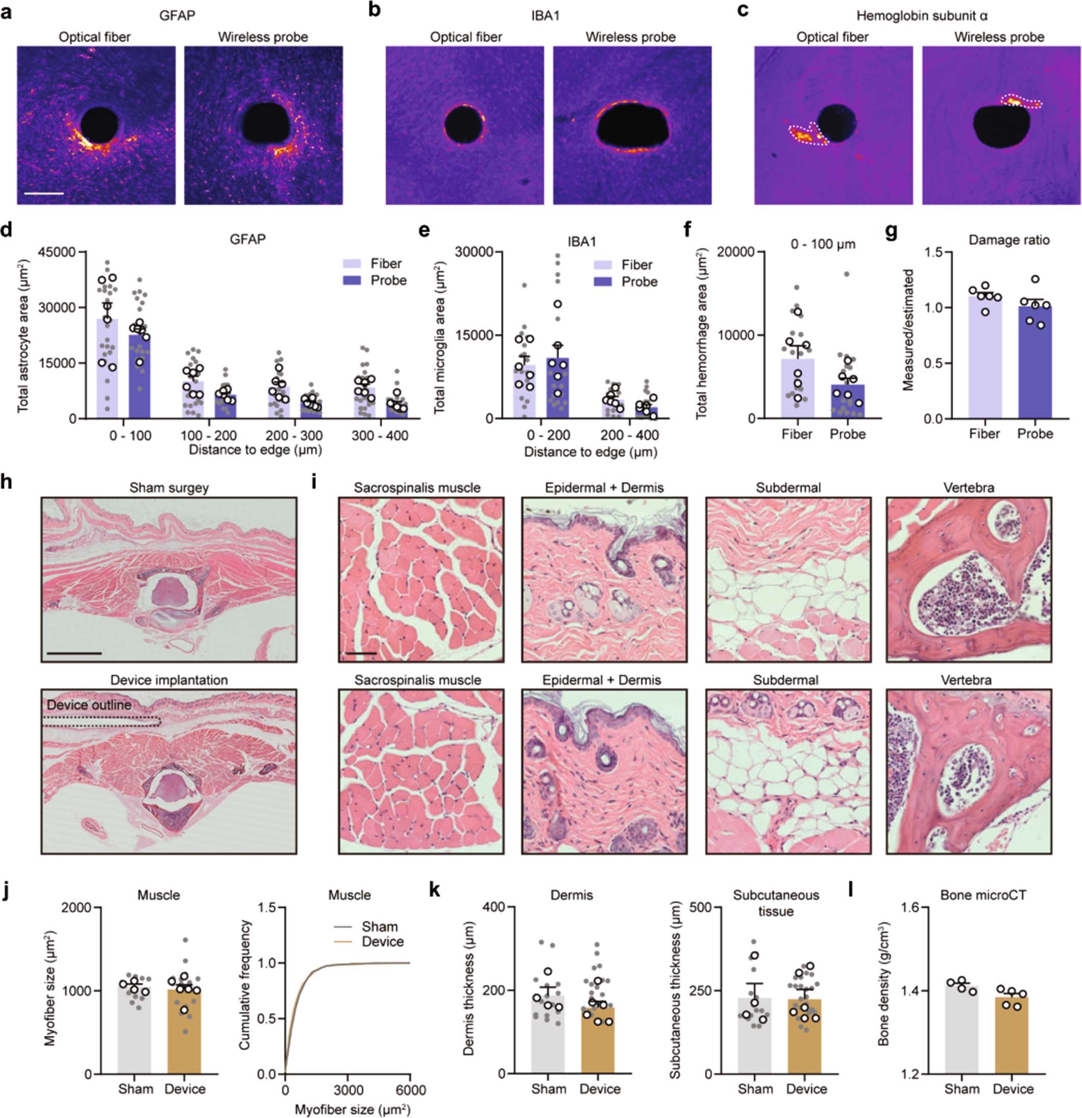 Extended Data Fig. 4: Biocompatibility of injectable probes and back mounted implants.