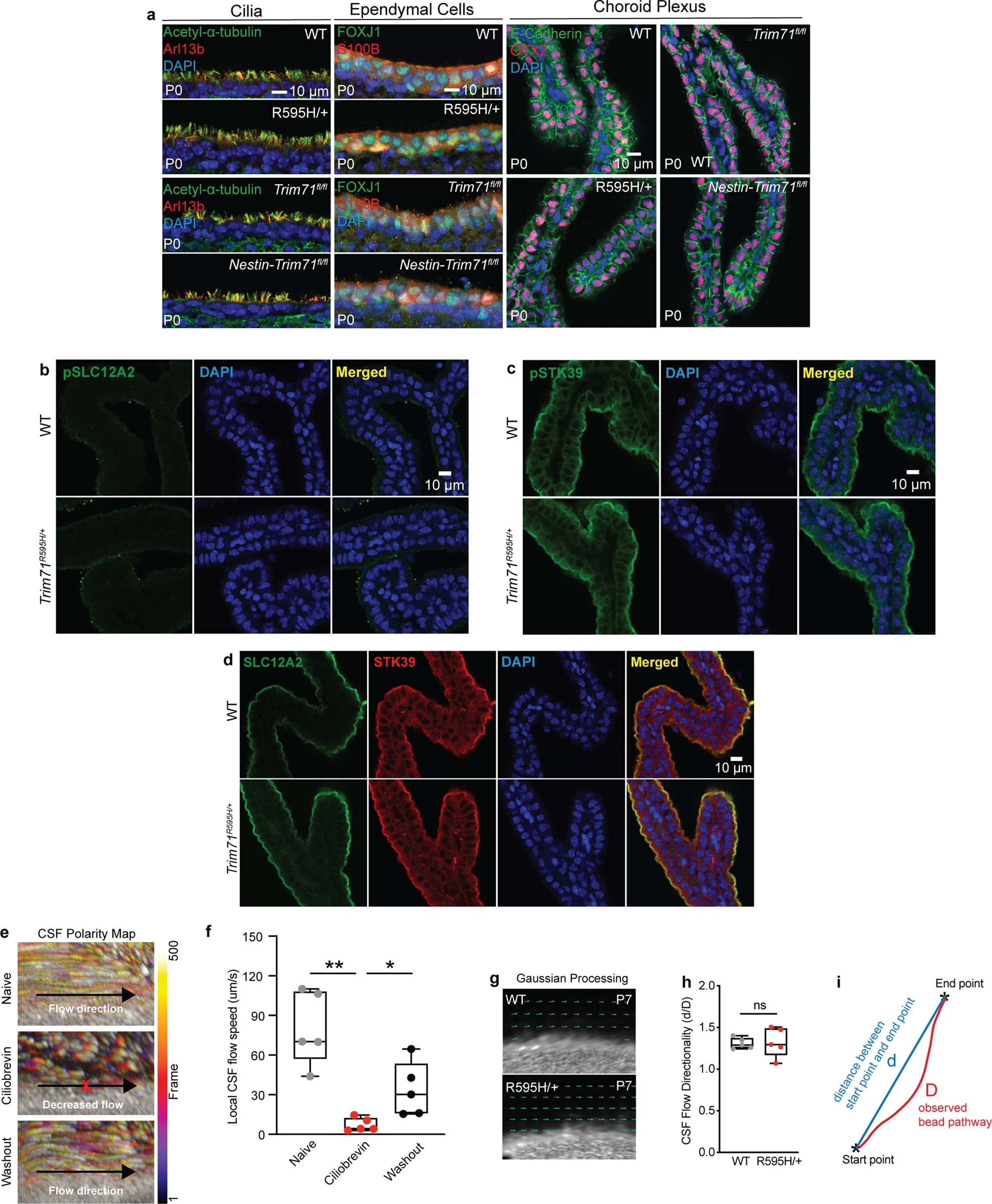 Extended Data Fig. 9: Characterization of ependymal cilia and choroid plexus in hydrocephalic Trim71 mutant mice.