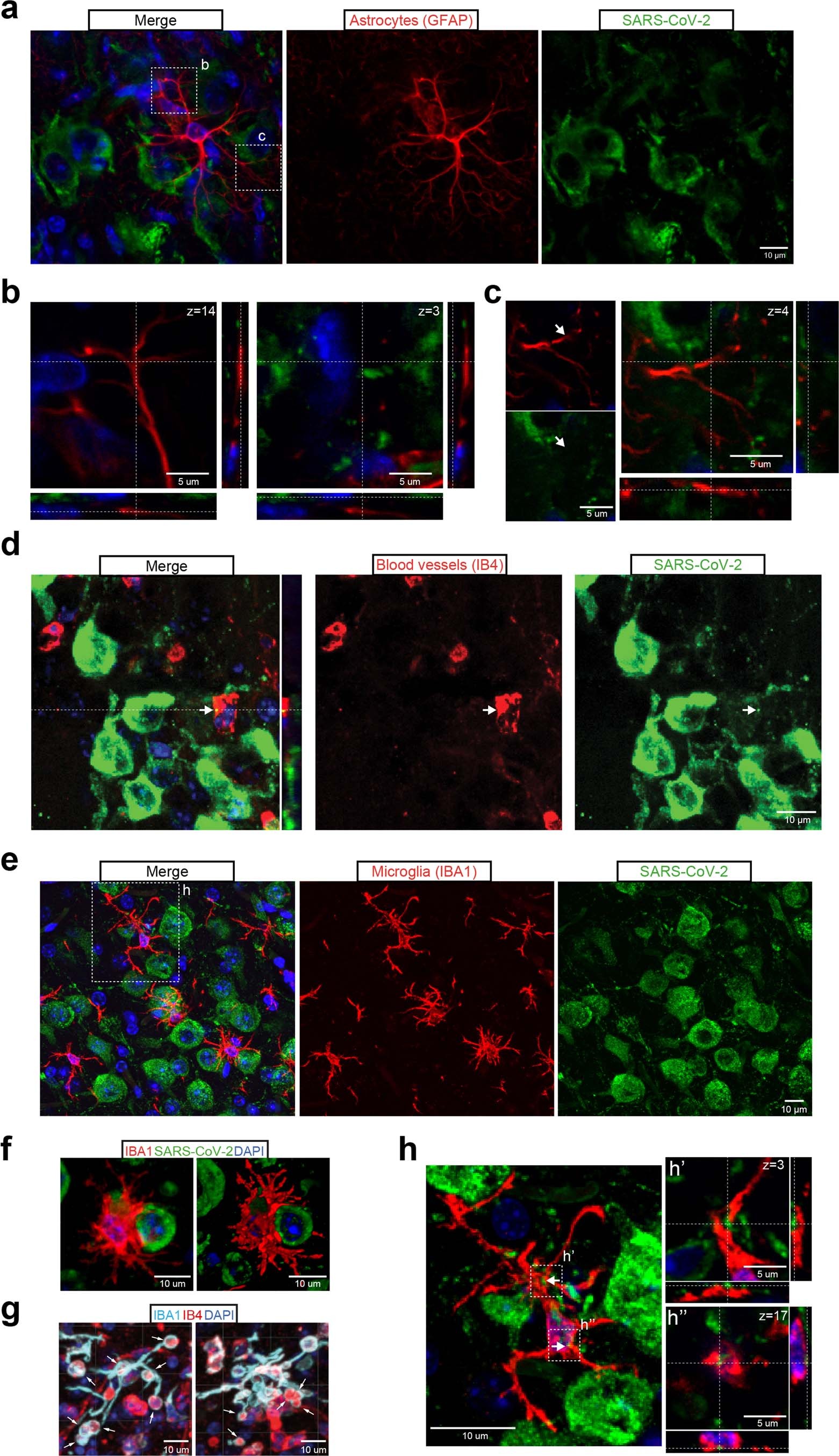 Extended Data Fig. 4: Colocalization analysis of SARS-CoV-2 N protein in glial or vascular brain cells.