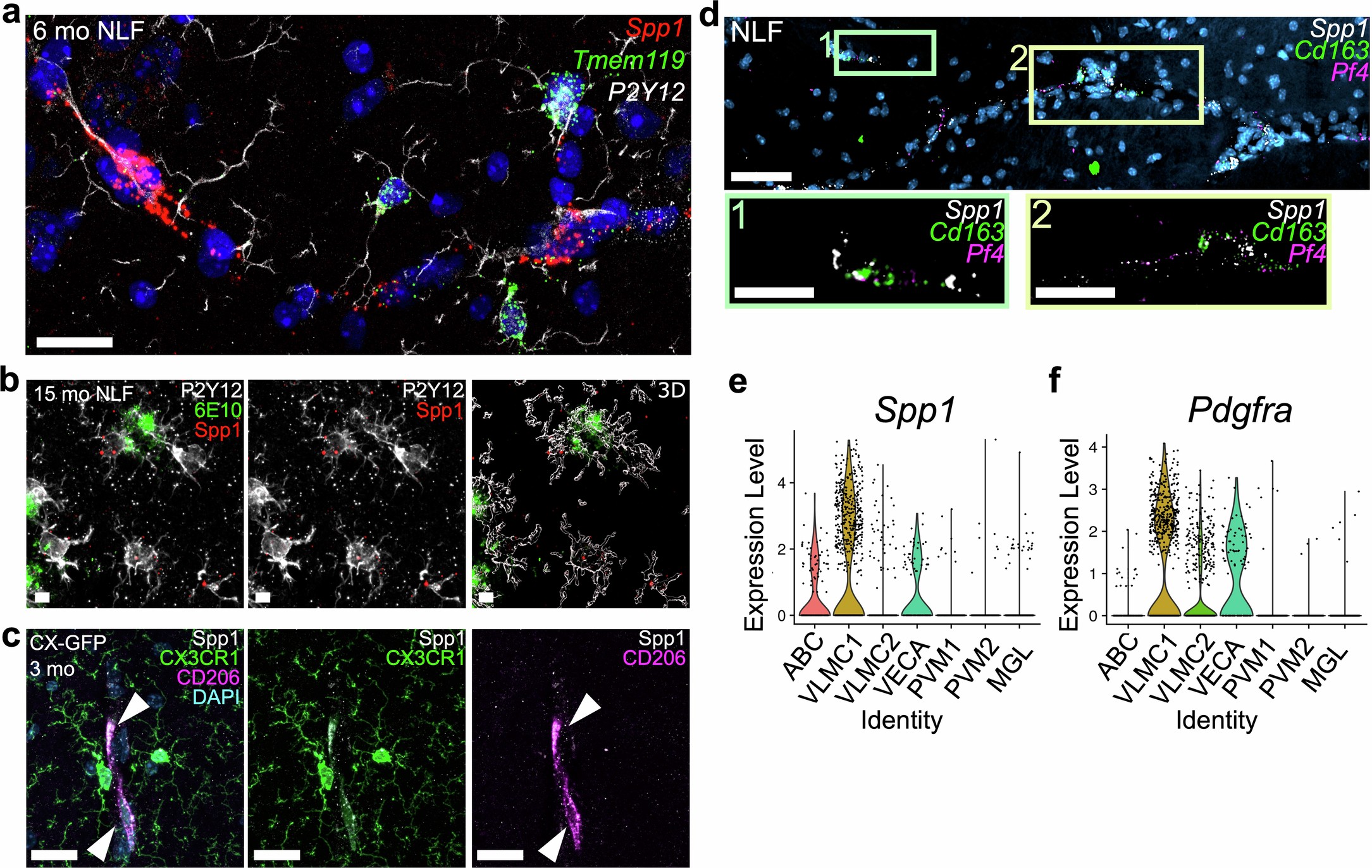 Extended Data Fig. 2: Spp1 is expressed in perivascular cells.
