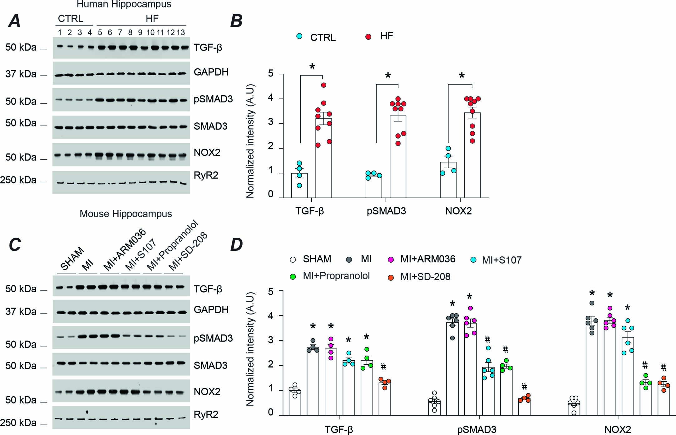 Extended Data Fig. 4: TGF-β activation in HF.