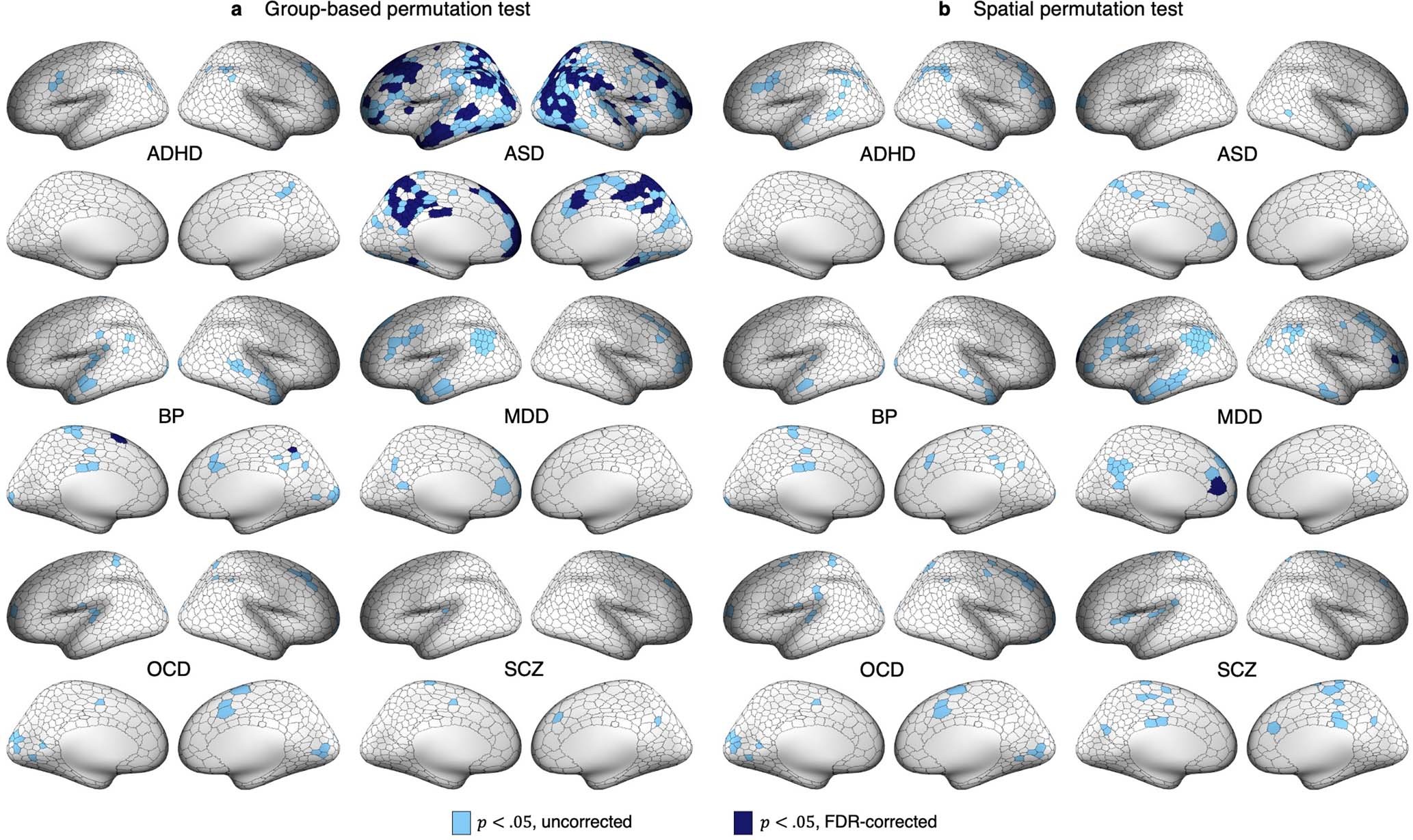 Extended Data Fig. 9: Regions showing greater overlap in areas functionally coupled to extreme positive GMV deviations in cases compared to controls.
