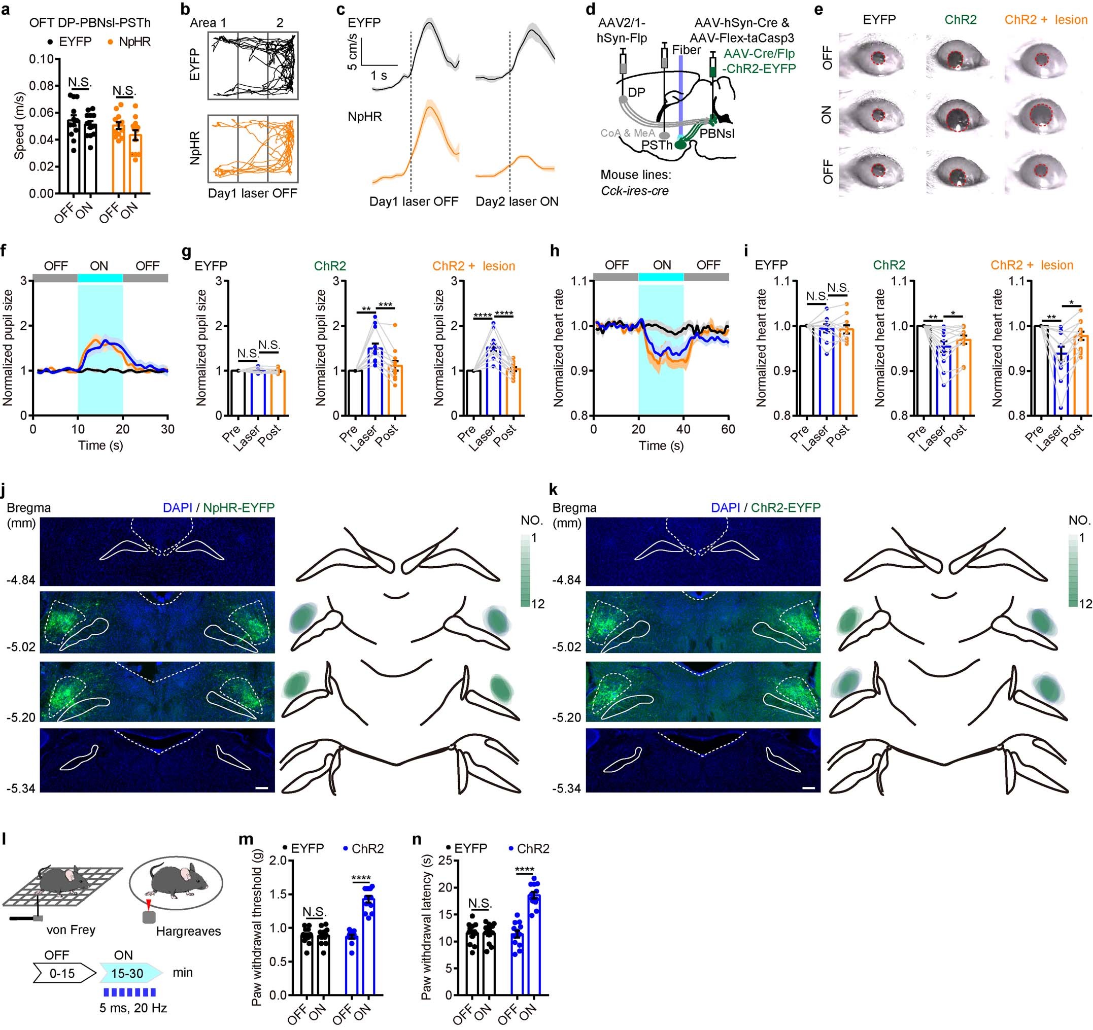 Extended Data Fig. 10: Effects of ablation of specific amygdala nuclei on DP→anterior PBNsl→PSTh circuit-triggered innate fear and pain threshold.