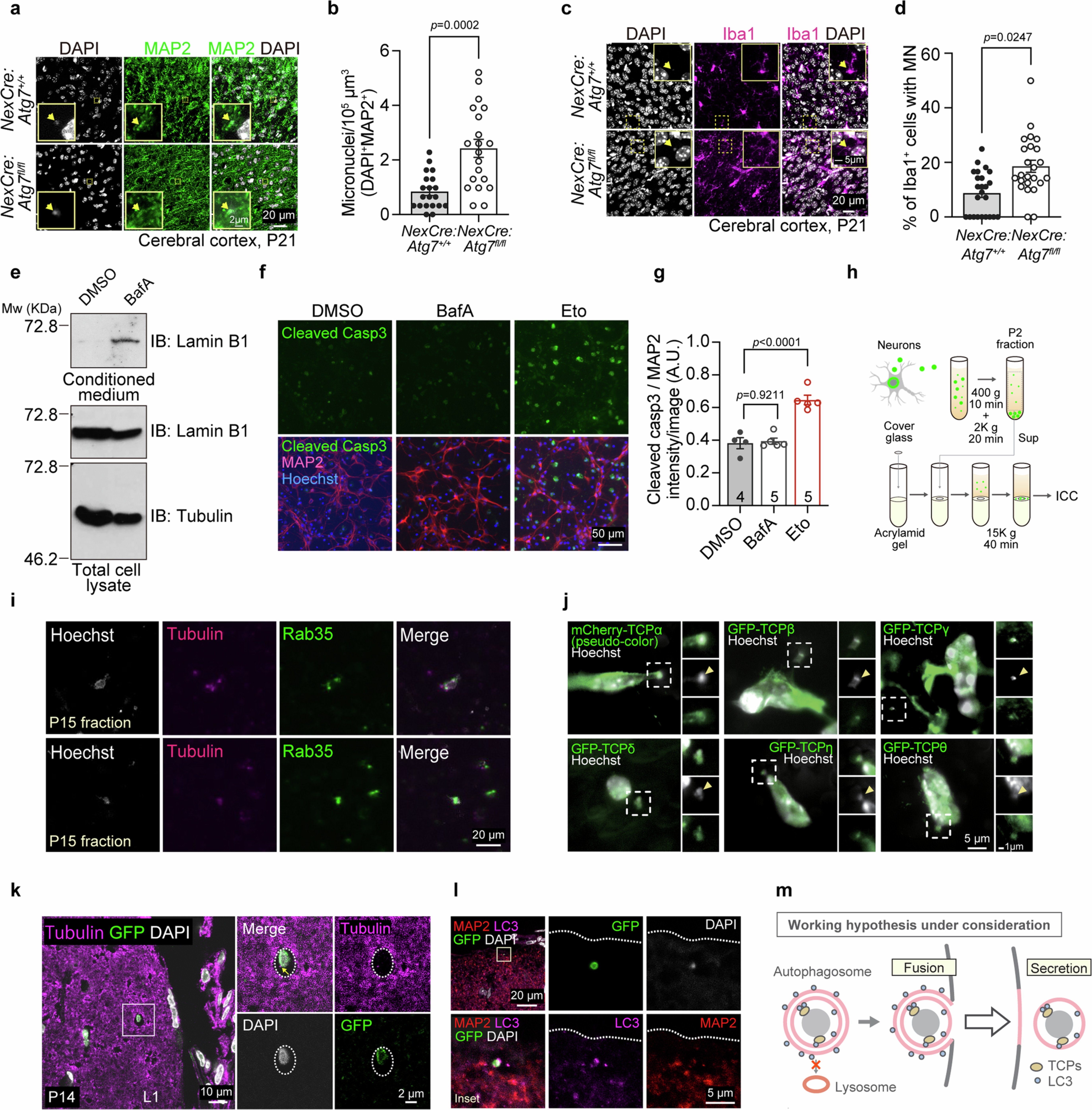 Extended Data Fig. 2: The autophagy pathway is involved in micronuclear secretion.