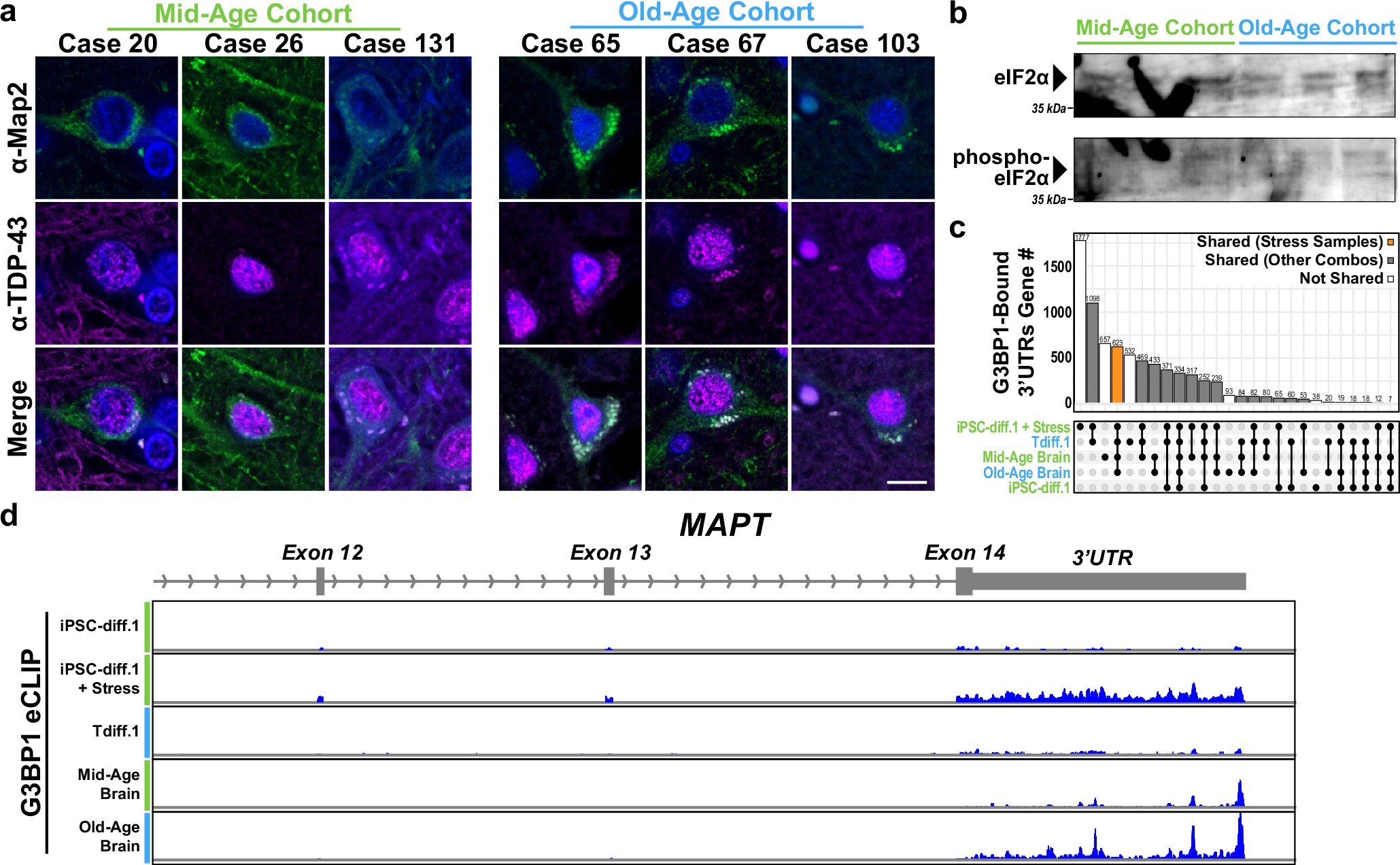 Extended Data Fig. 10: The aging human brain has cytoplasmic TDP-43 foci.