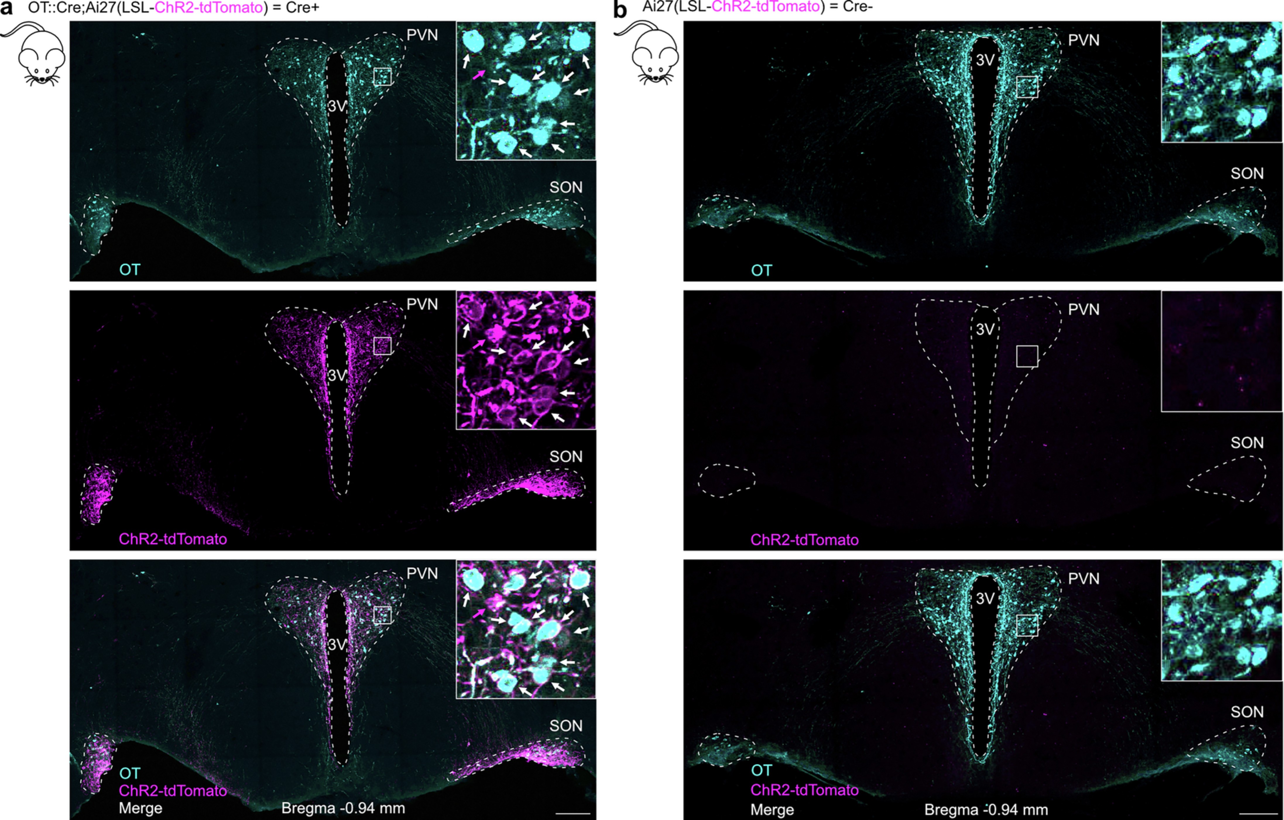 Extended Data Fig. 2: Specificity of ChR2-tdTomato expression in the OT neurons of OT::Cre;Ai27(LSL-ChR2-tdTomato) mice.