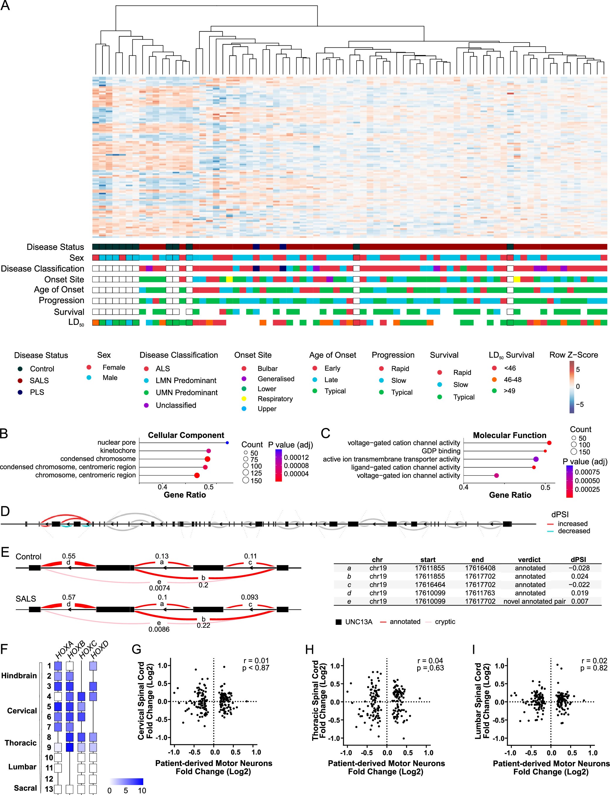 Extended Data Fig. 6: Clinical and in vitro transcriptional and splicing profiles of SALS motor neurons.