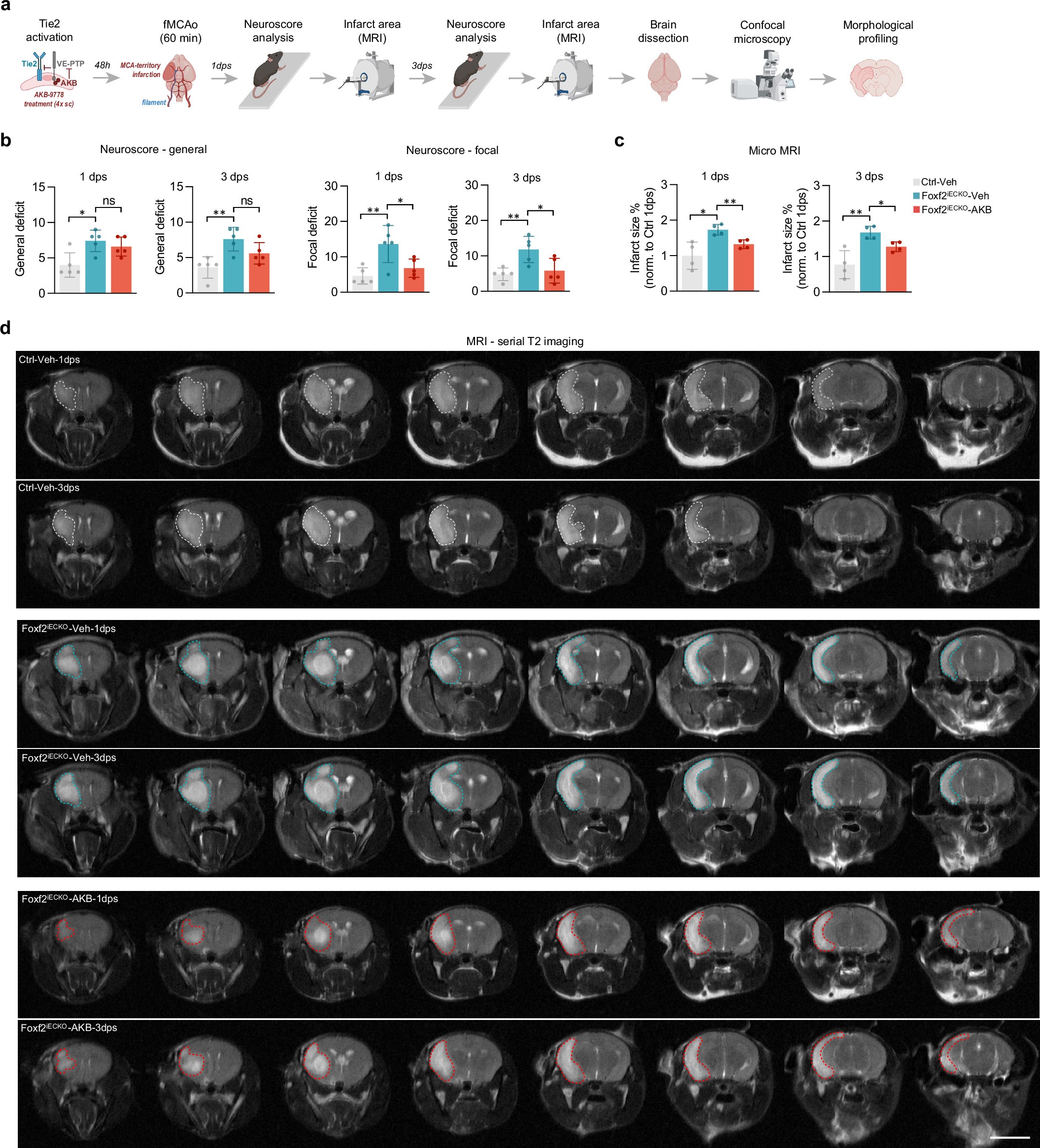 Extended Data Fig. 8: Assessment of neurological deficits and infarct size 1 and 3 days after stroke in Foxf2iECKO and Ctrl mice treated with either vehicle or AKB-9778 prior to fMCAO.