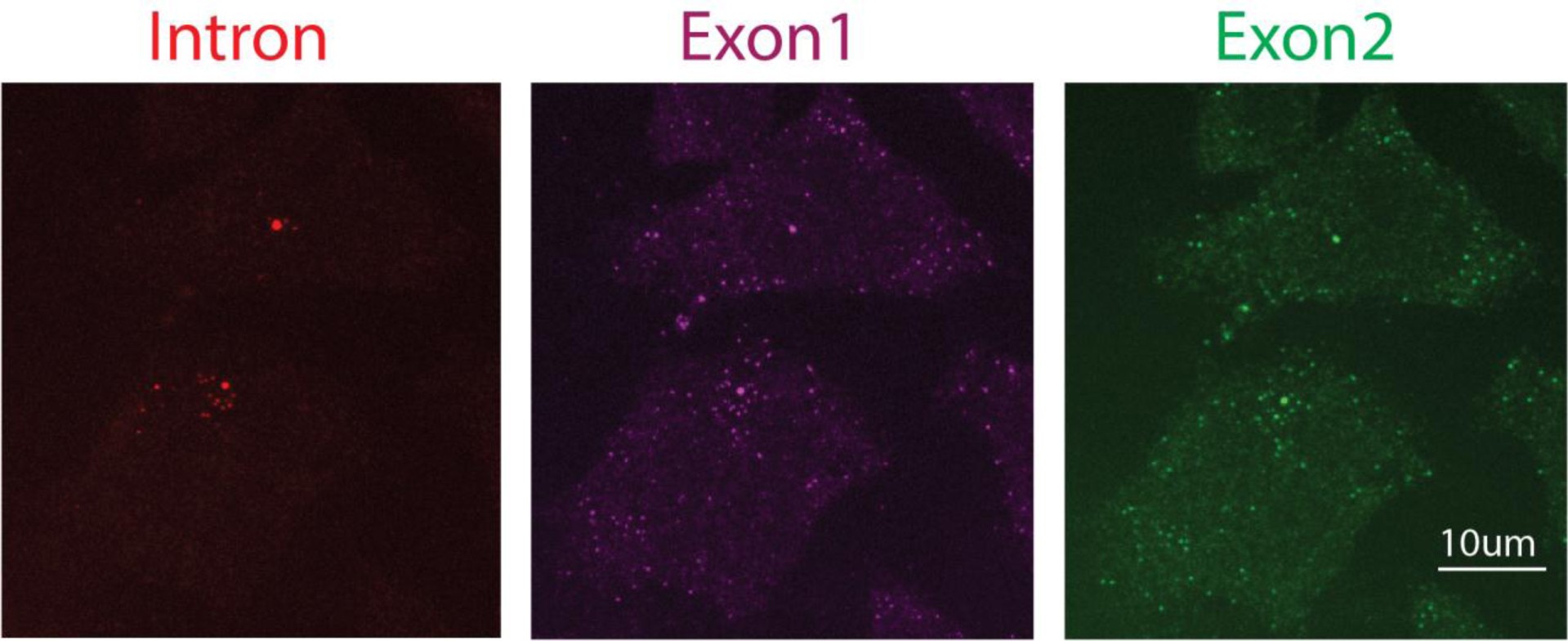 Supplementary Figure 8: Examples of different TASs.