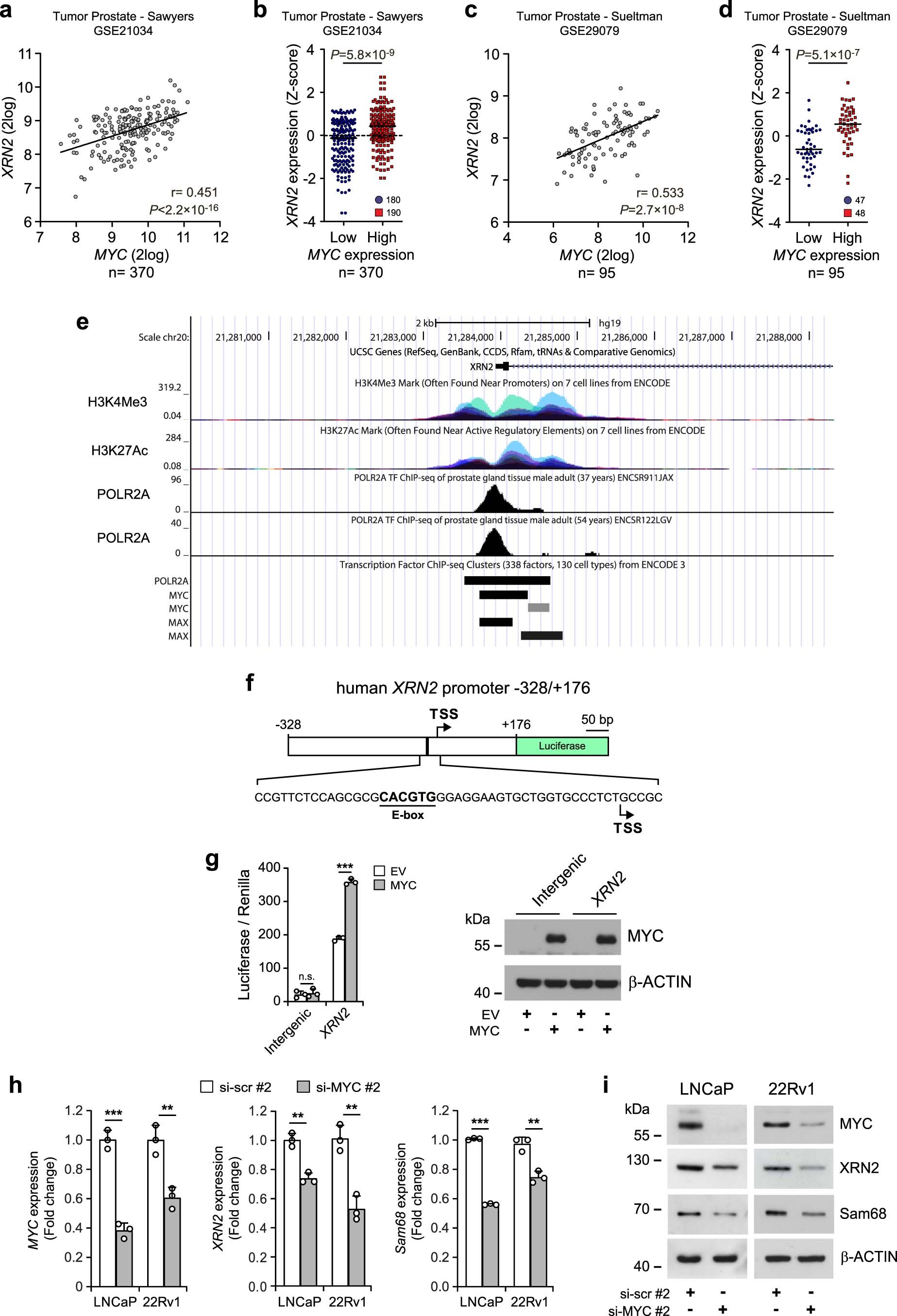 Extended Data Fig. 4: XRN2 and MYC expression are correlated in PC (Related to Fig. 3).
