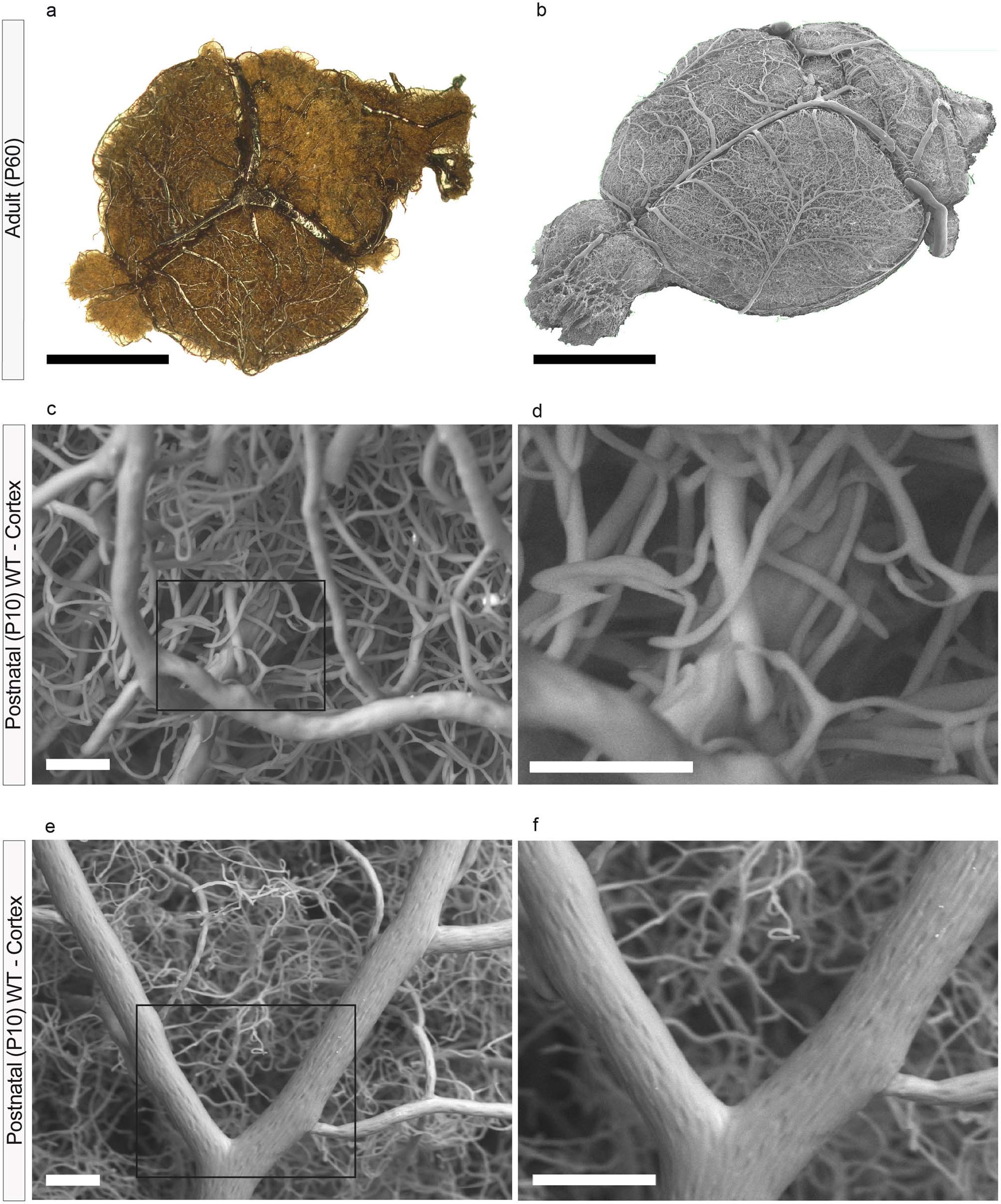 Extended Data Fig. 2: Validation of vascular corrosion casting in postnatal (P10) and adult (P60) mice using light microscopy (LM) and SEM.