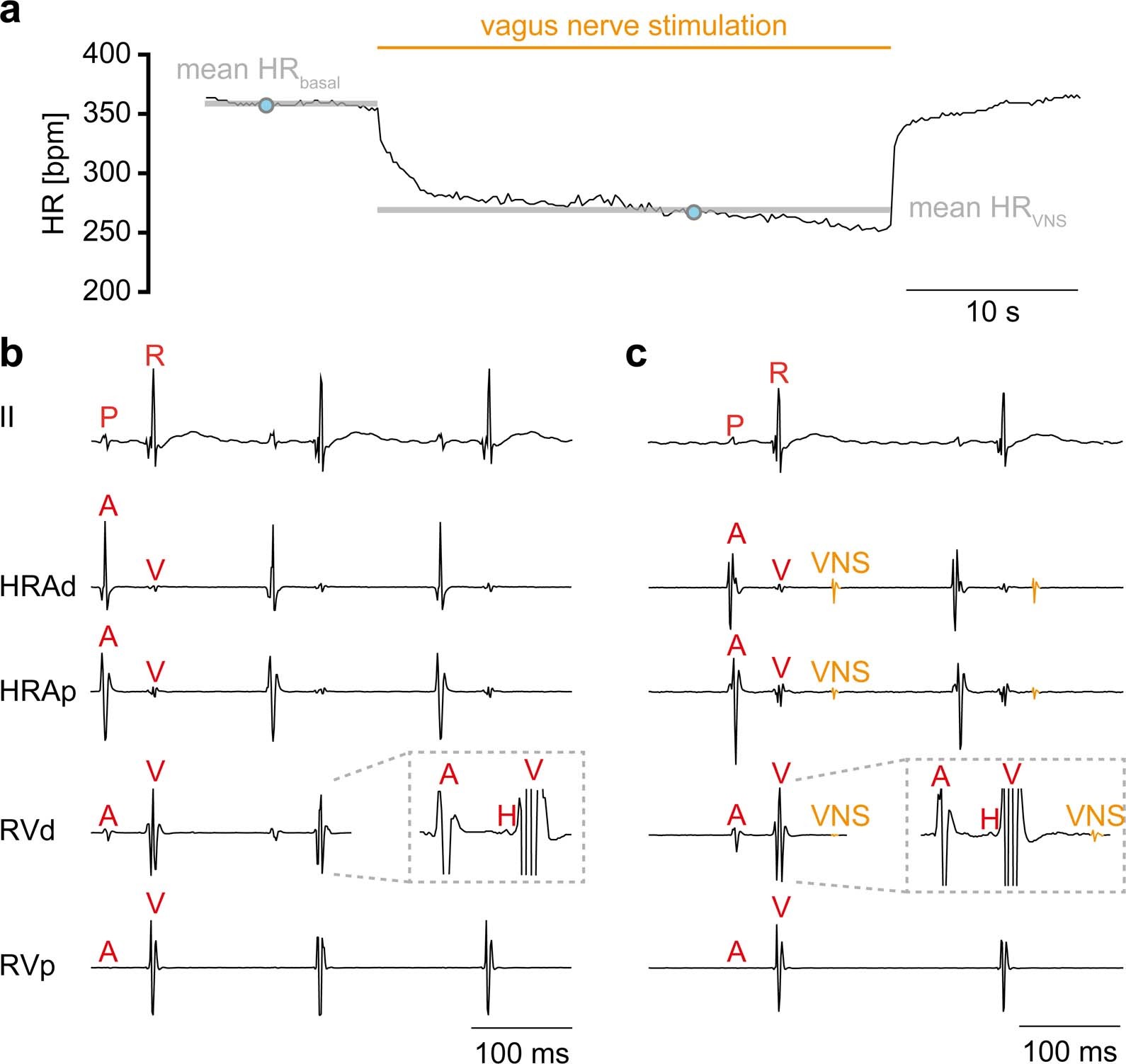 Extended Data Fig. 8: Ex vivo surface and intracardiac ECG recording under baseline conditions and during VNS.