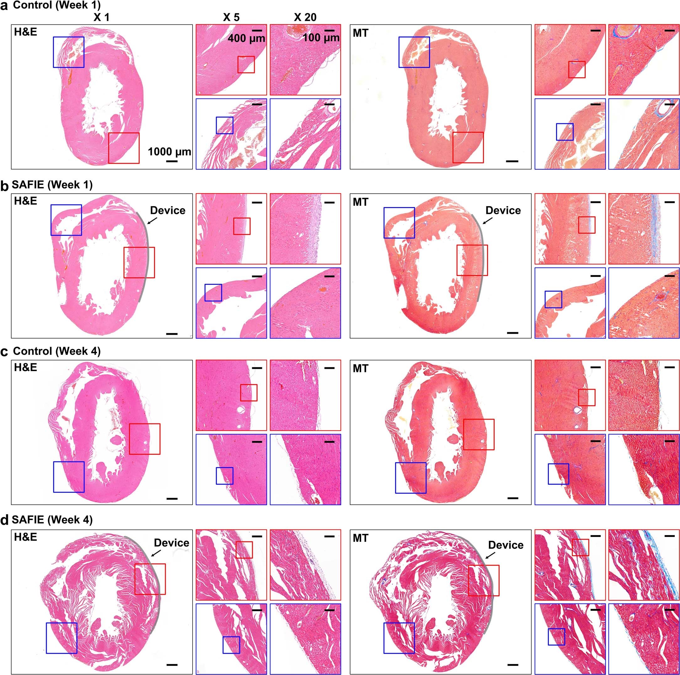 Extended Data Fig. 6: Histological analysis at 1-week and 4-week implantation of the SAFIE patch.