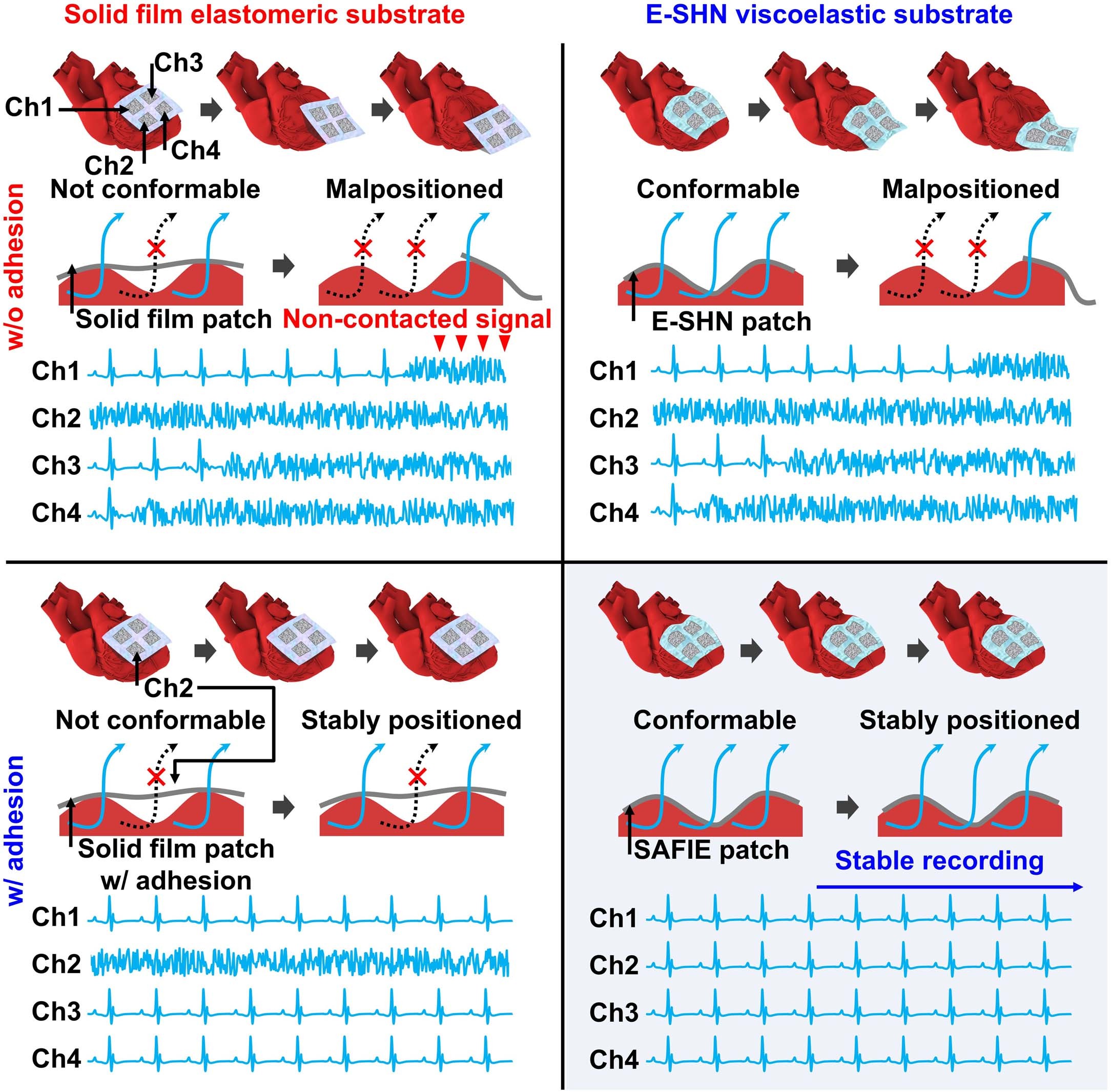 Extended Data Fig. 1: Comparison of stable ECG recording of SAFIE patch to that of conventional ECG sensors without tissue adhesion and conformability.