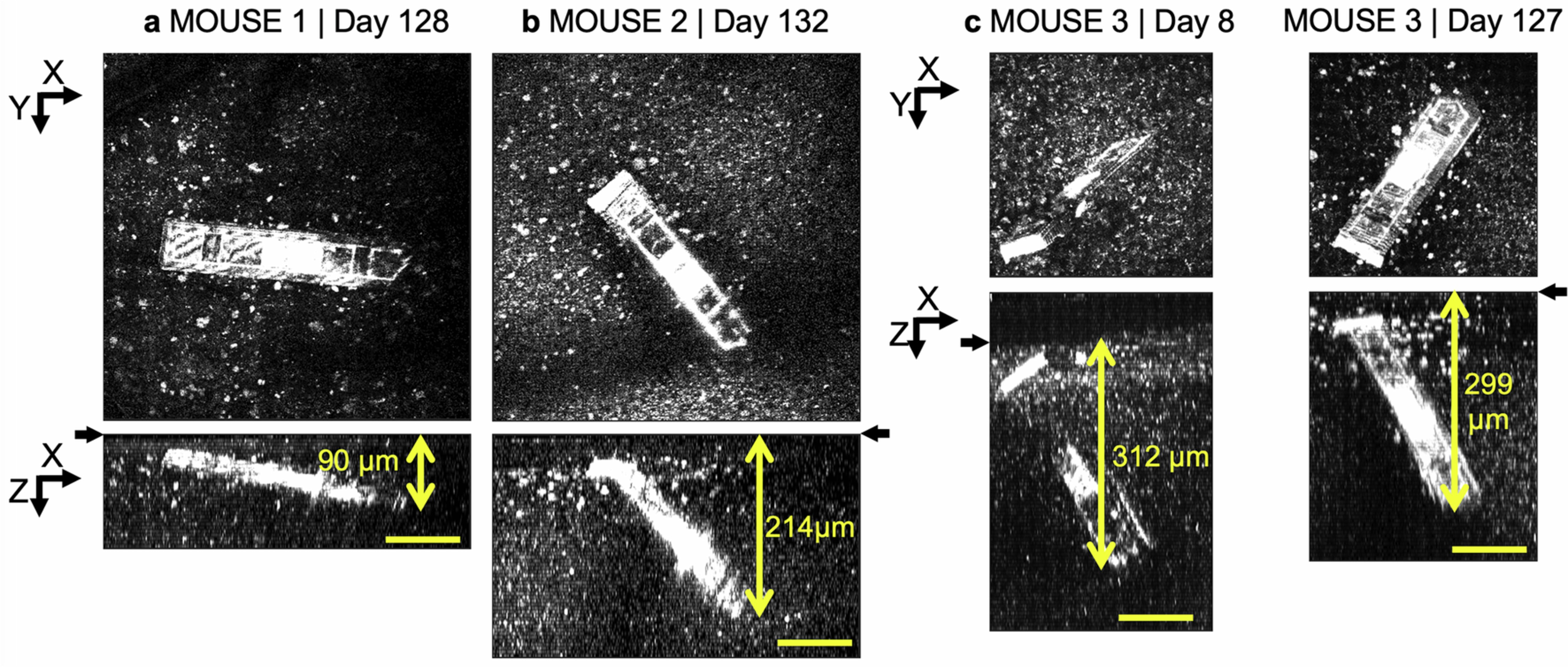 Extended Data Fig. 7: Intravital three-photon microscopy images of MOTEs in mouse brains.