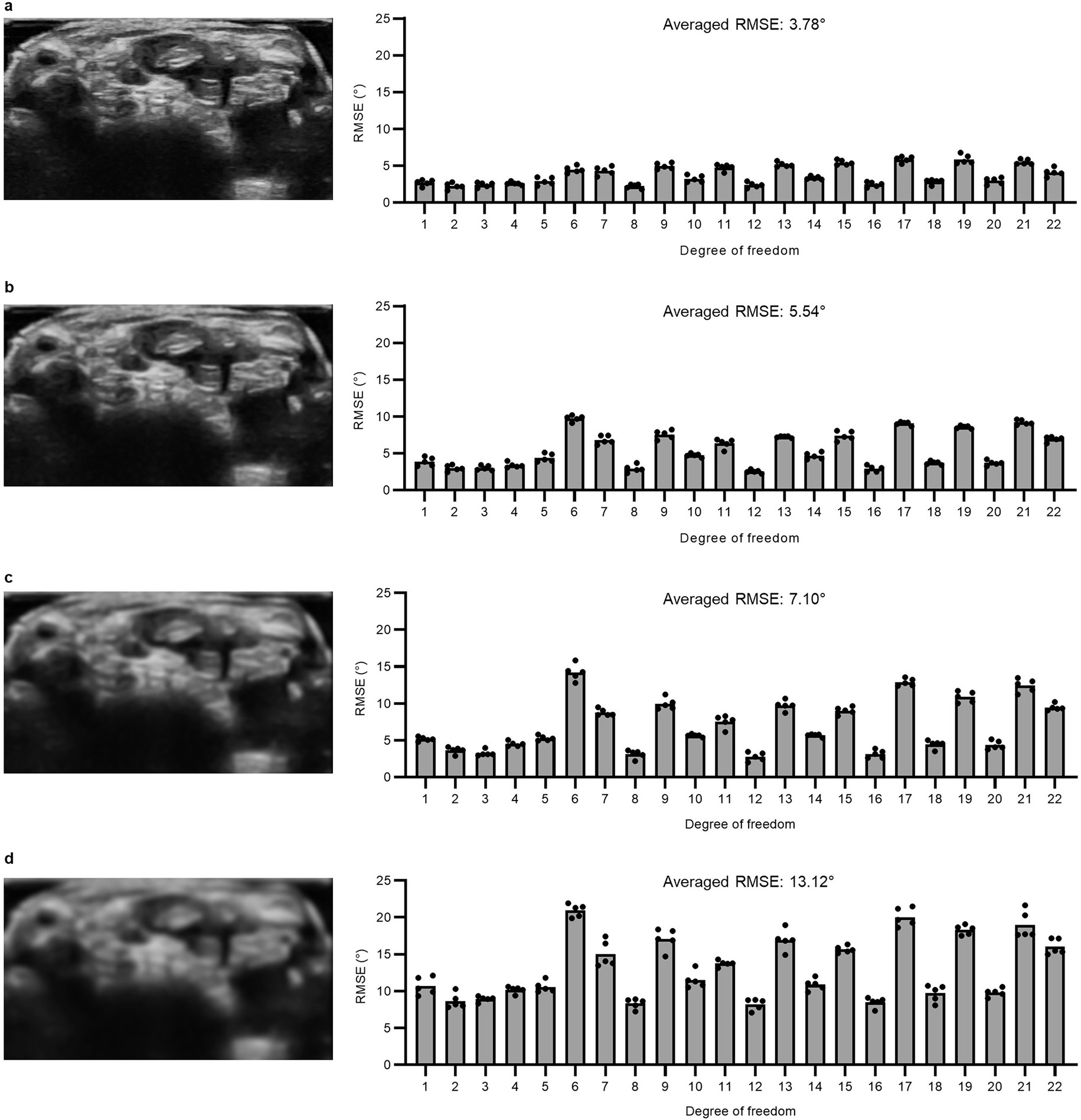 Extended Data Fig. 9: Evaluation of the resolution dependent tracking accuracy using the ultrasound wristband.