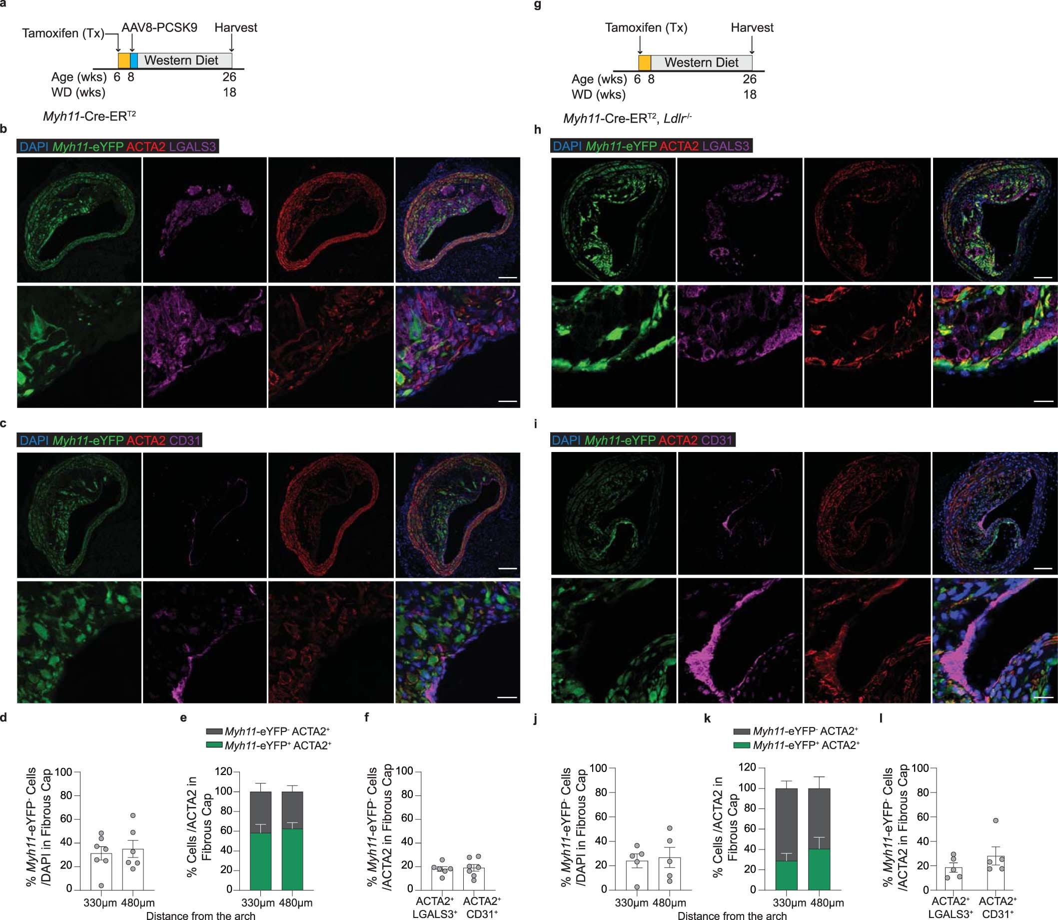 Extended Data Fig. 5: Analysis of BCA lesions from gain of function mutant (m) PCSK9-AAV8 and Ldlr−/− models of murine atherosclerosis.