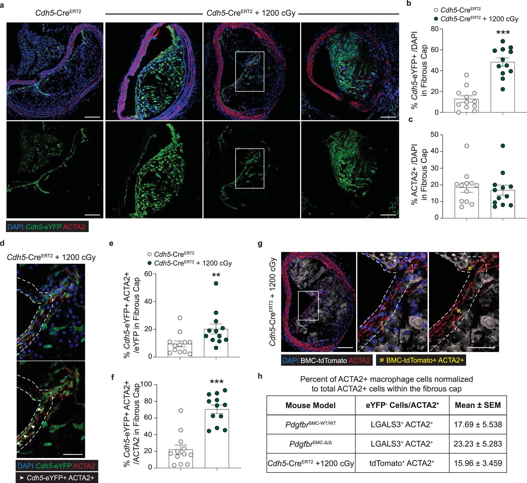 Extended Data Fig. 7: Lethal radiation and BMT significantly increases the percentage of EC in the lesion and fibrous cap.