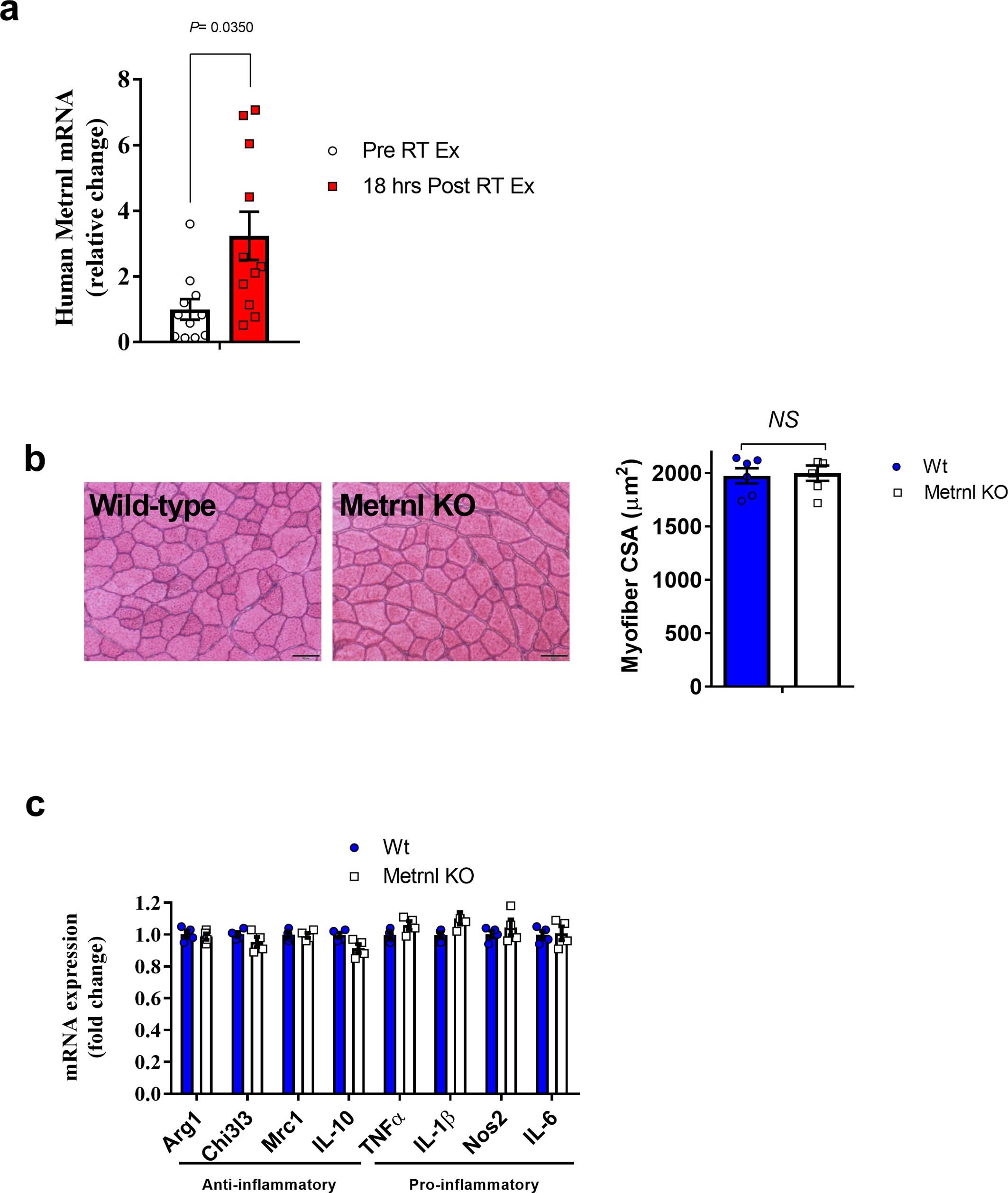 Extended Data Fig. 1: Metrnl mRNA expression with human muscle damage and CSA analysis of uninjured Metrnl KO muscle.