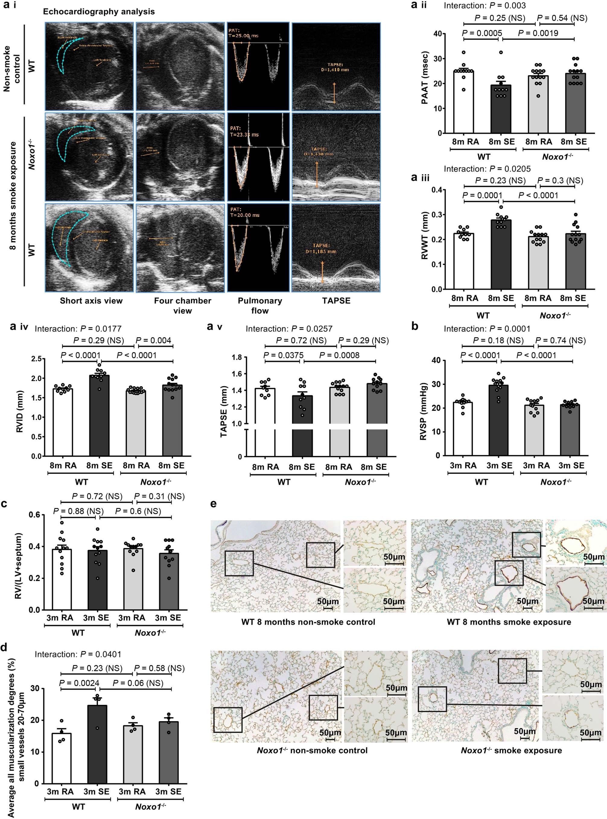 Extended Data Fig. 4: In vivo and ex vivo characterization of parameters reflecting PH, right heart structure and function, and histology of the vasculature in WT and Noxo1−/− mice with and without smoke exposure.
