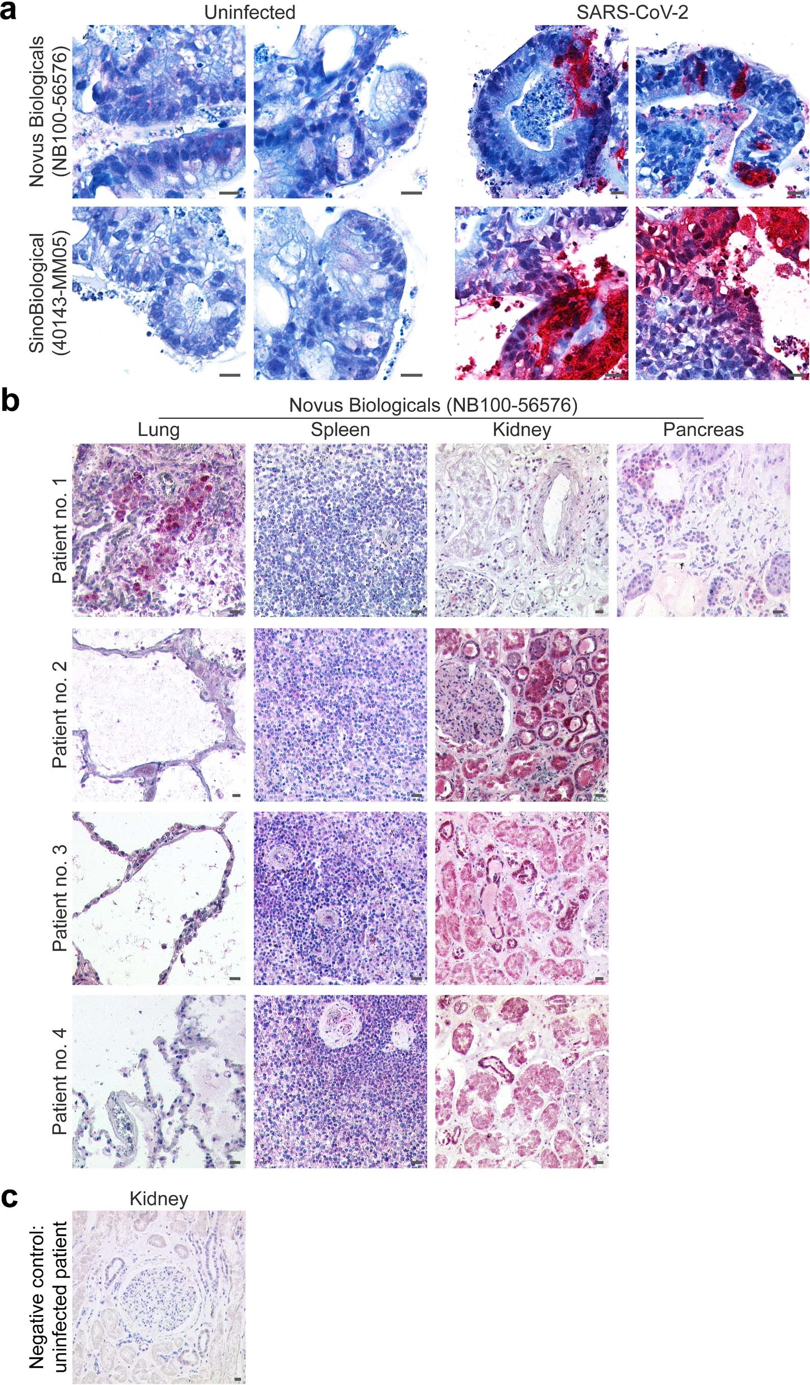 Extended Data Fig. 8