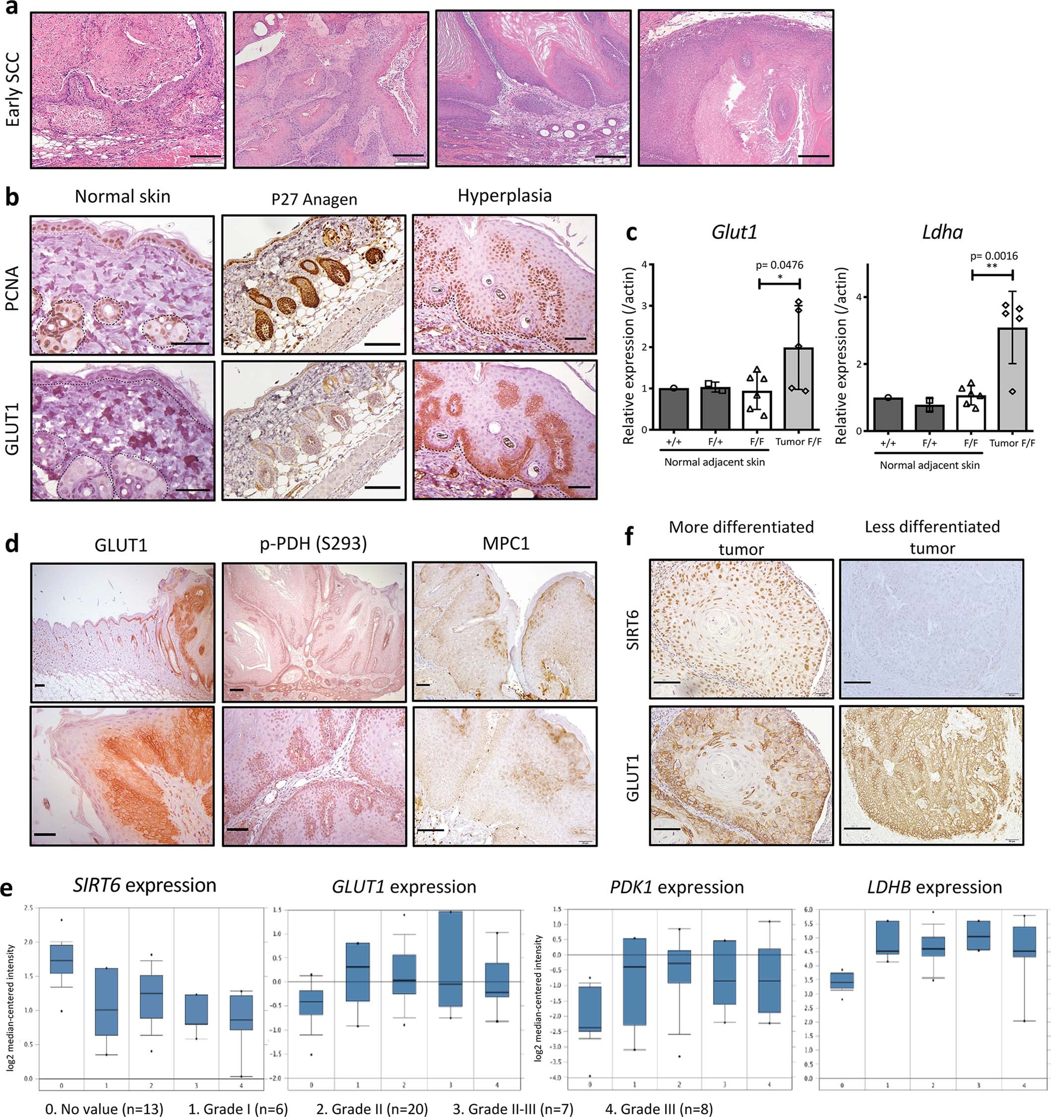 Extended Data Fig. 2: Dysplastic cancer cells presented increased glycolysis in an in vivo model of cutaneous SCC and in human HNSCC in the context of SIRT6.