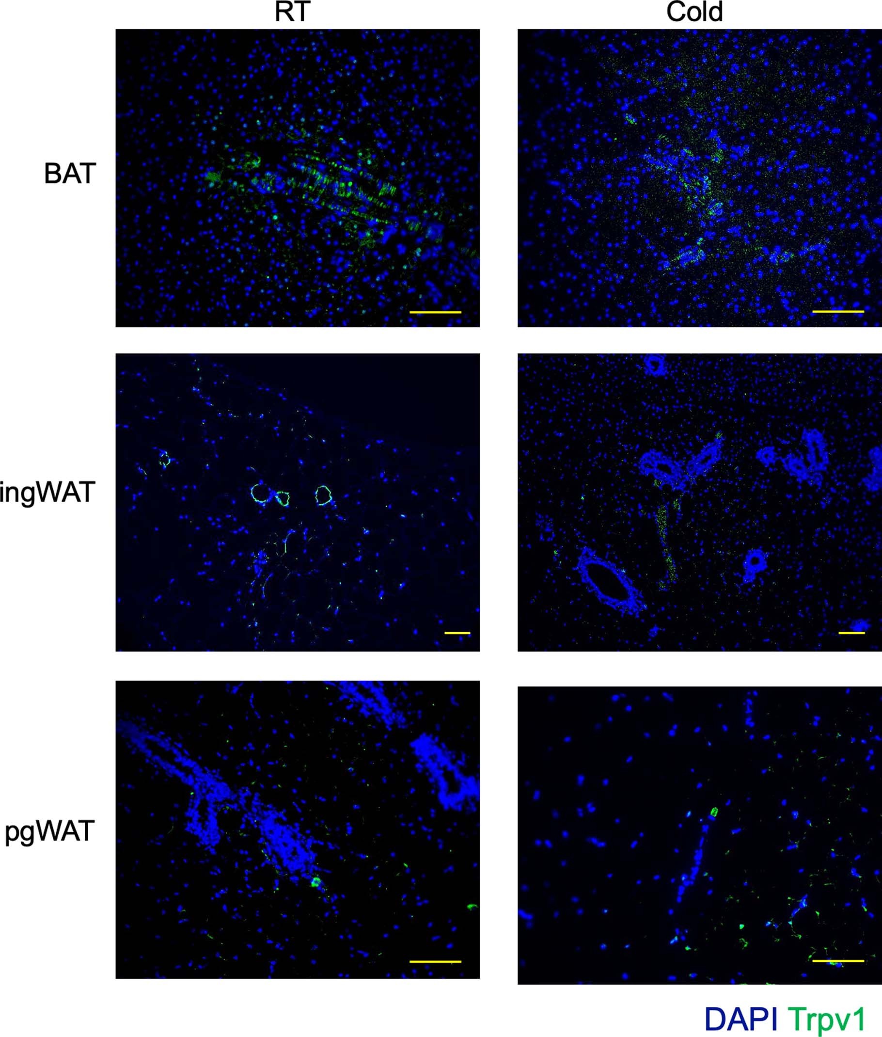 Extended Data Fig. 4: Trpv1 expression is restricted to adipose tissue vasculature, related to Fig. 2.