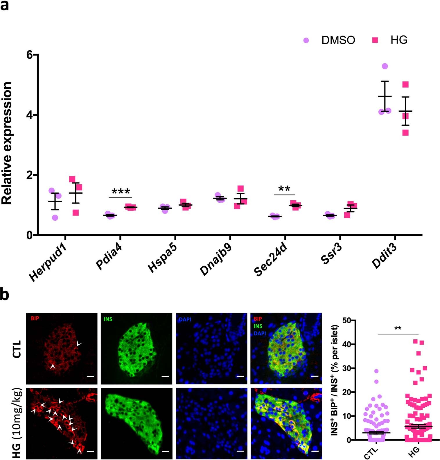 Extended Data Fig. 4: The UPR is necessary for HG-induced β-cell proliferation (related to Fig. 7).