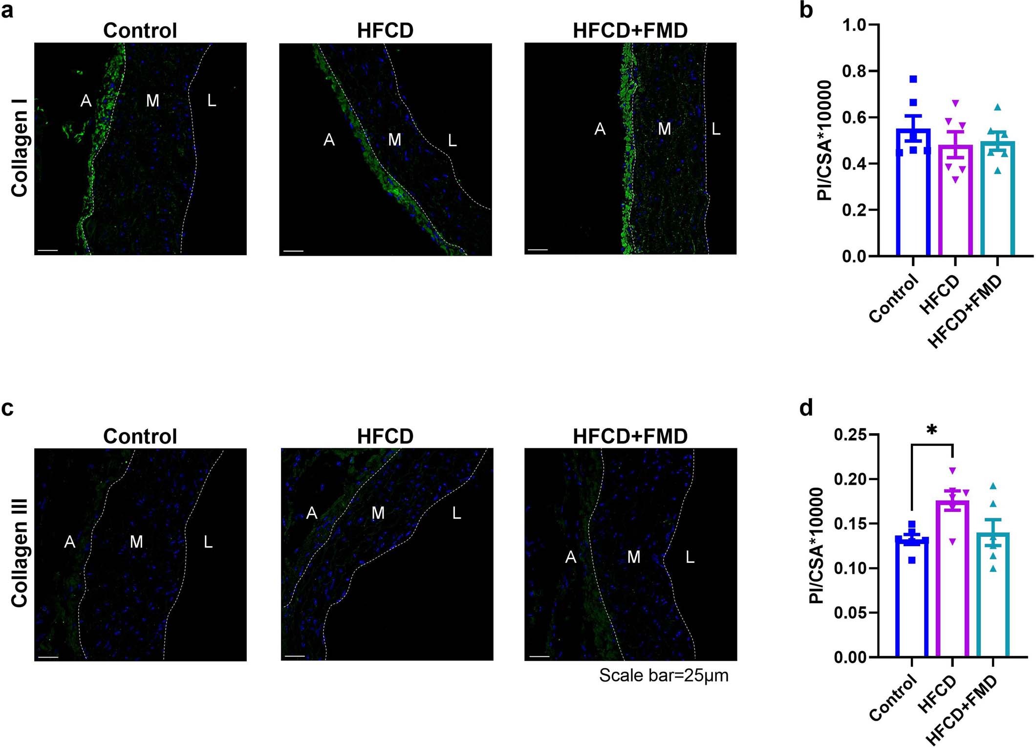 Extended Data Fig. 3: Collagen I and collagen III staining and quantification in aorta.