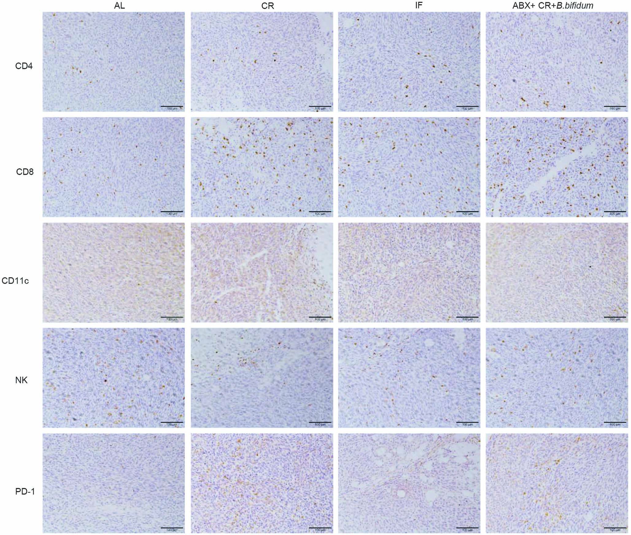 Extended Data Fig. 4: CR and B.bifidum treatment reshaped the tumor immune environment.