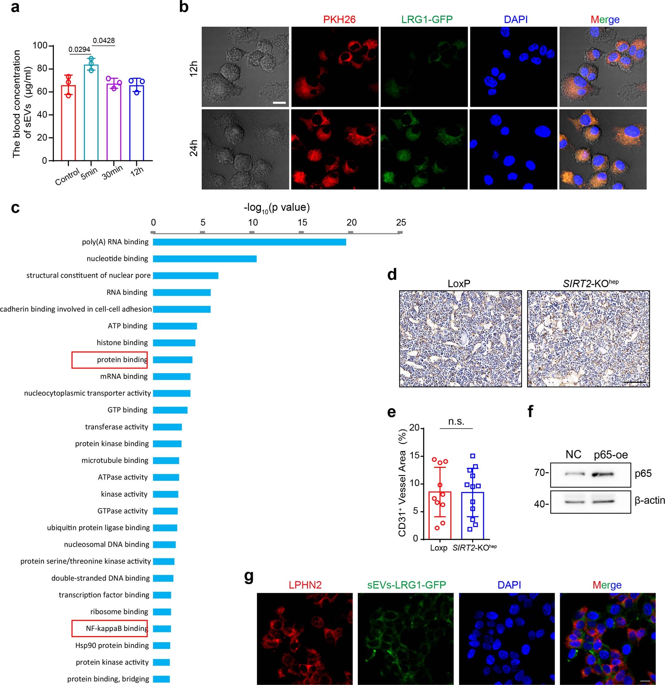 Extended Data Fig. 7: Hepatocyte-derived sEV-LRG1 suppresses osteoclast differentiation by inhibiting NF-κB p65 nuclear translocation, independently of angiogenesis.