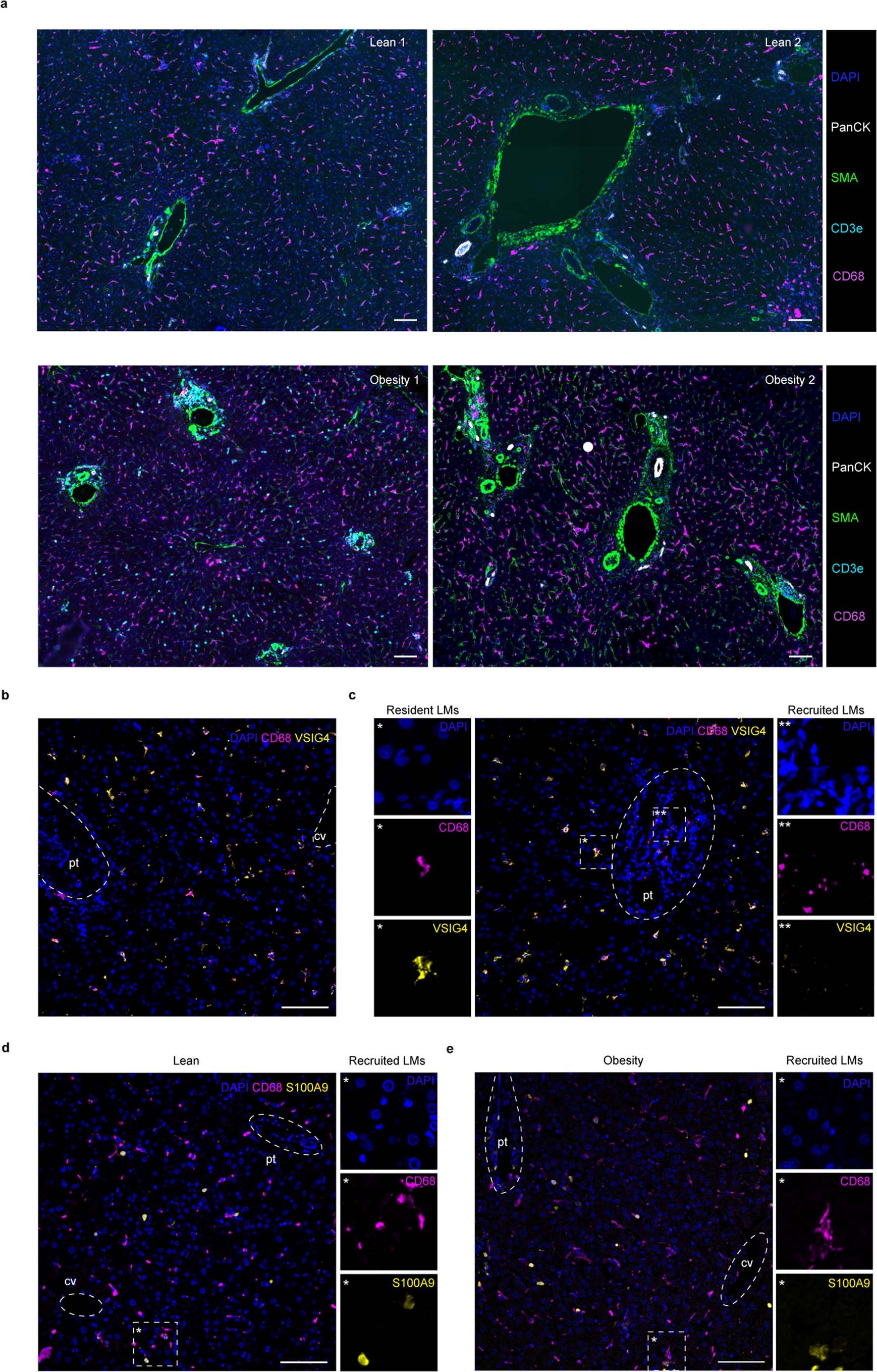 Extended Data Fig. 8: Characterisation of human liver myeloid cell localisation.