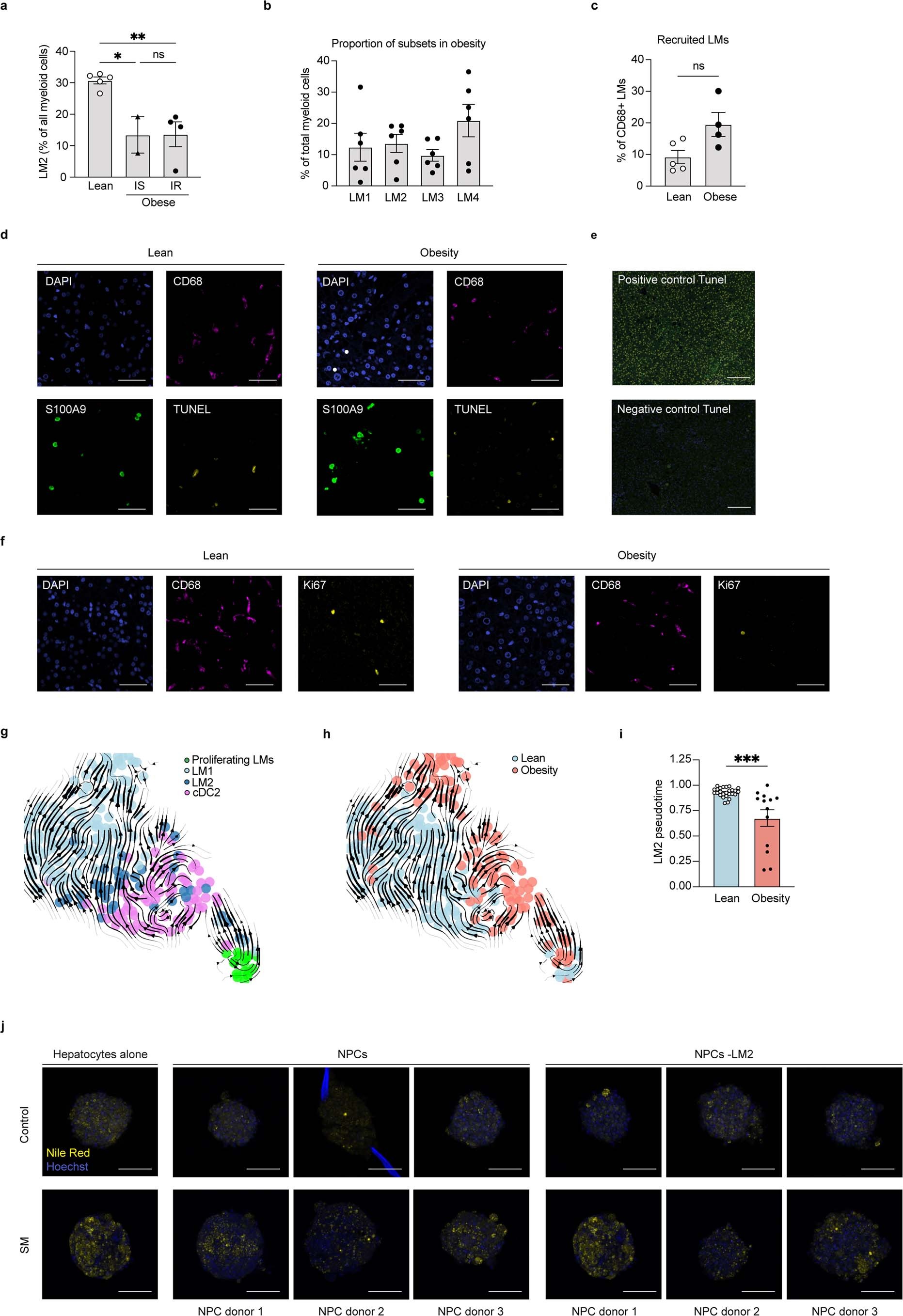 Extended Data Fig. 10: Characterisation of LM2 in obesity-induced metabolic disease.