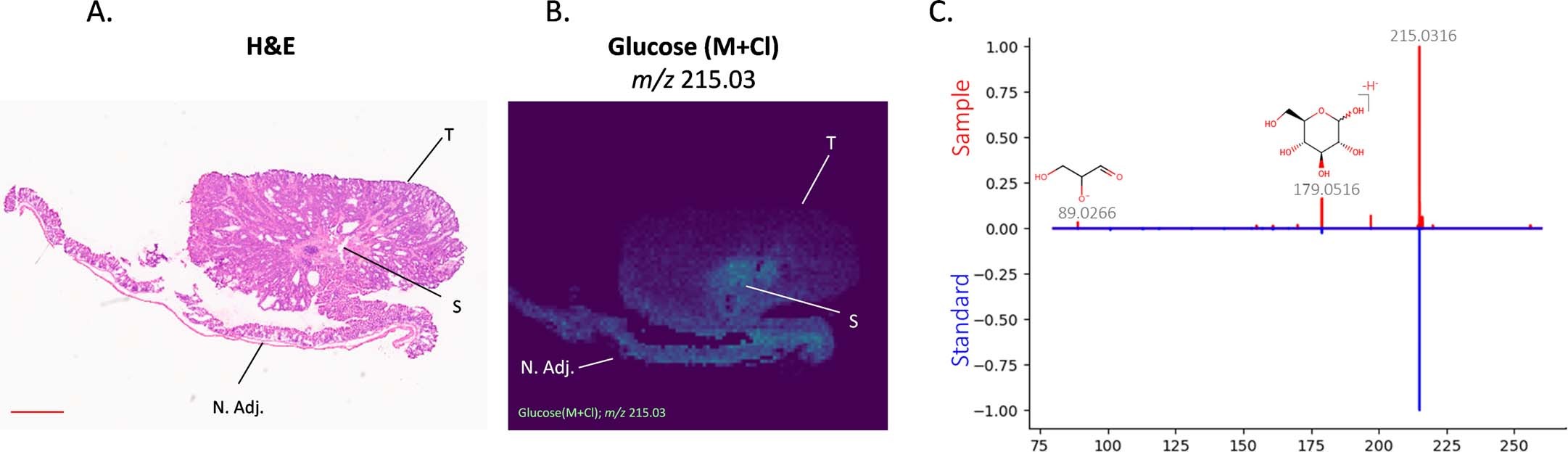 Extended Data Fig. 2: Decreased glucose abundance in tumour epithelium.