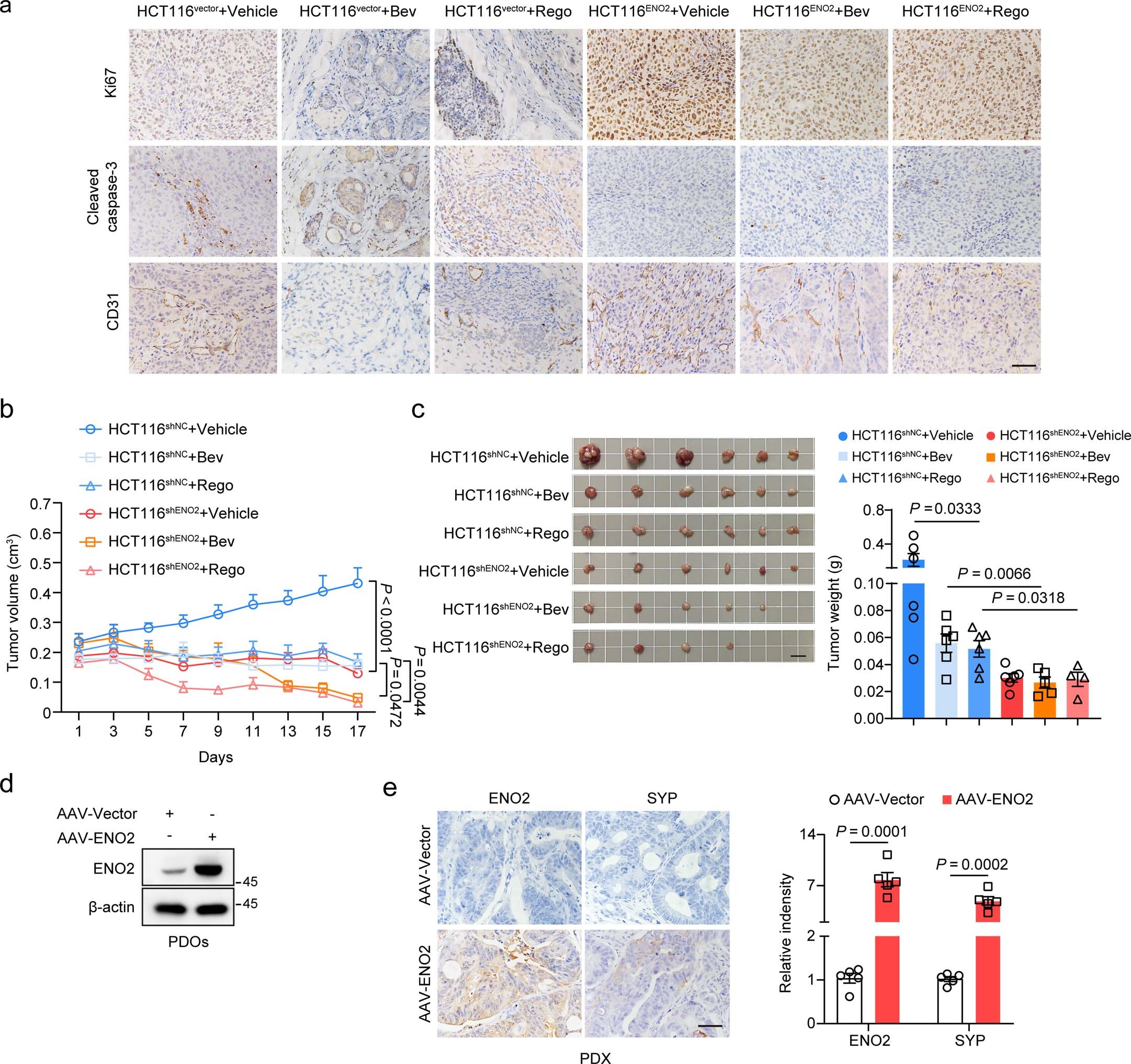 Extended Data Fig. 5: ENO2 affects the therapeutic efficacy of bevacizumab and regorafenib in CRC xenograft and PDX models.