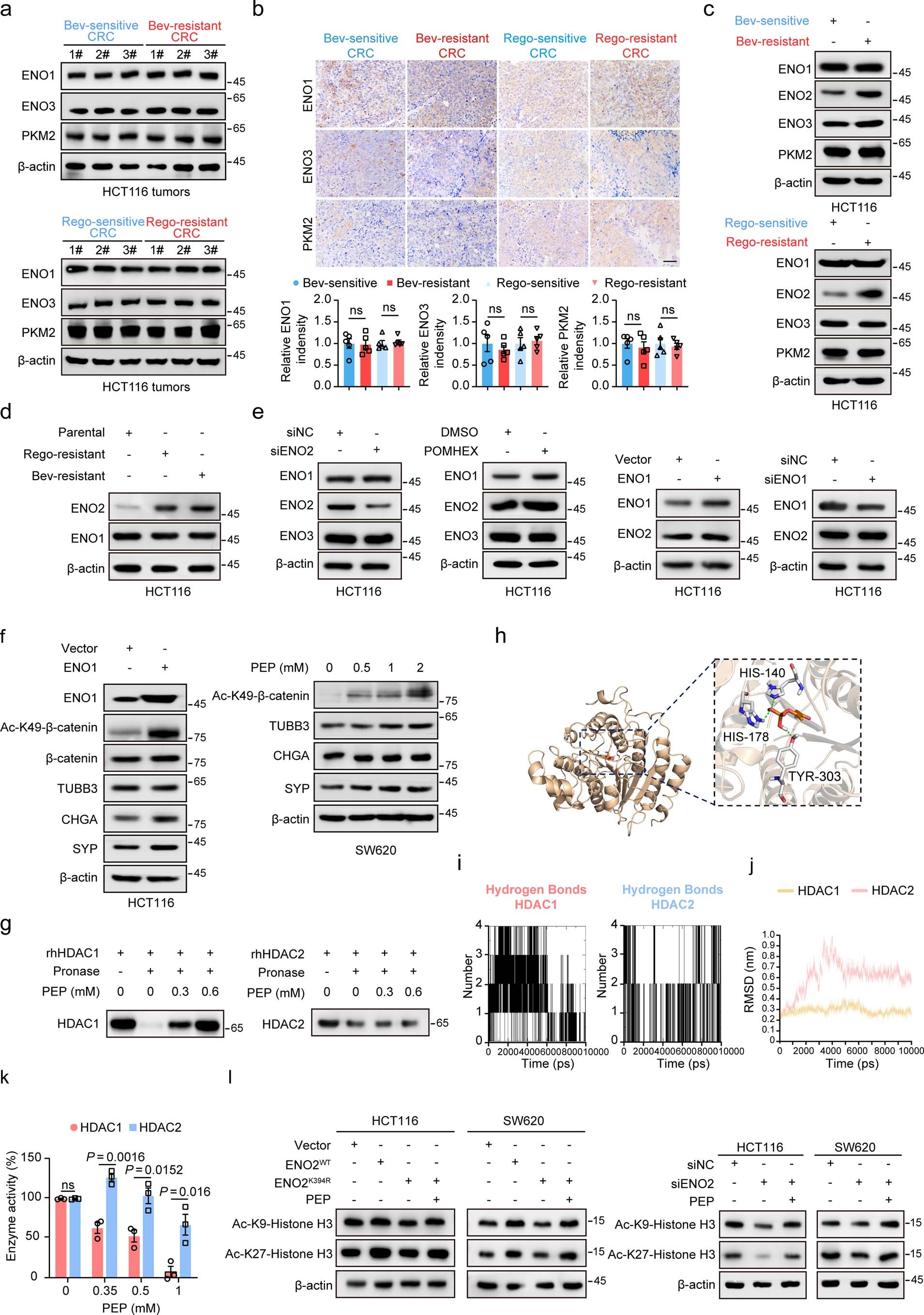 Extended Data Fig. 10: The ENO2/PEP/HDAC1 signaling contributes to ENO2-mediated β-catenin acetylation in CRC cells.