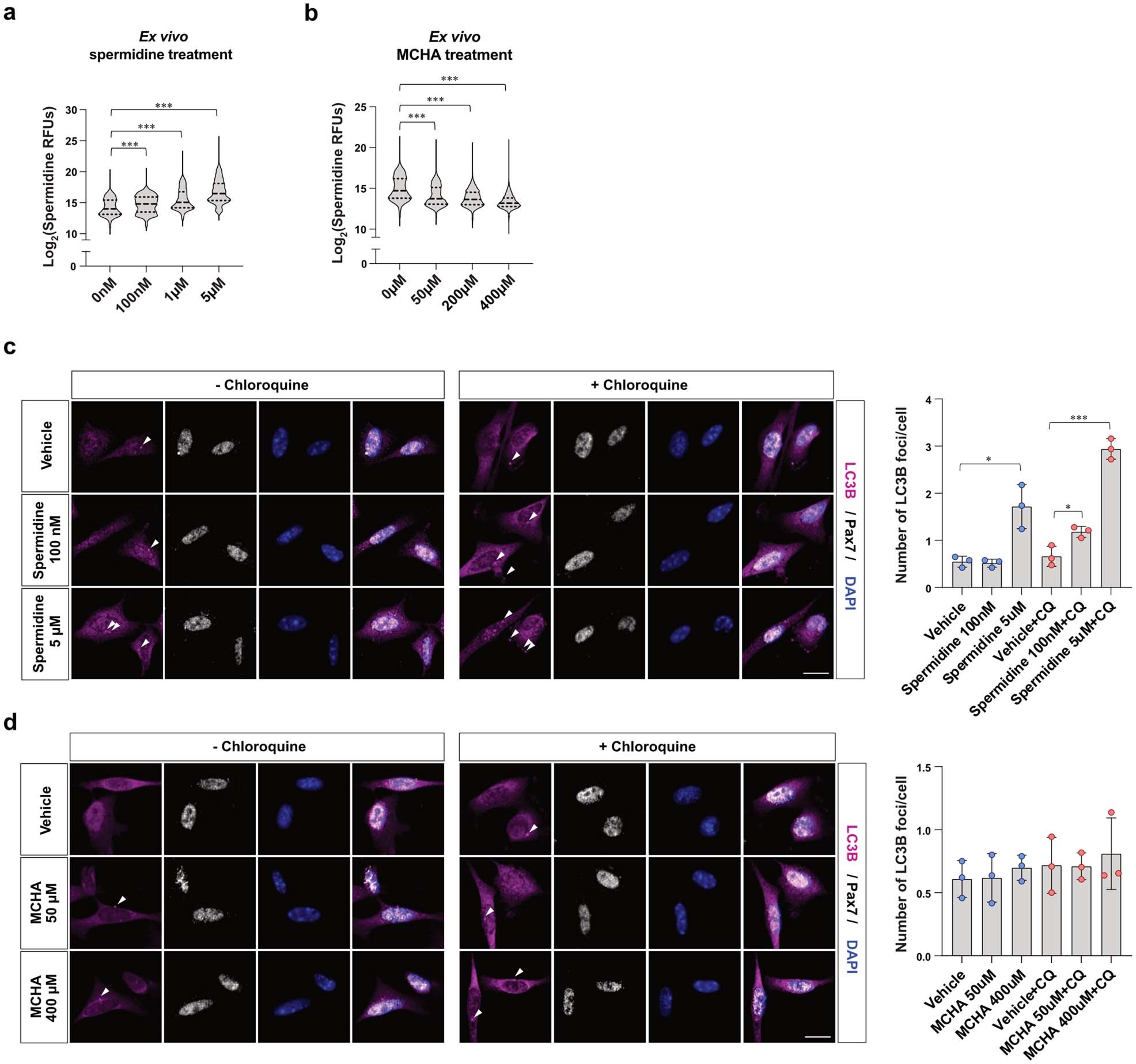 Extended Data Fig. 5: Inhibiting spermidine synthesis does not impair autophagy of aged MuSCs.