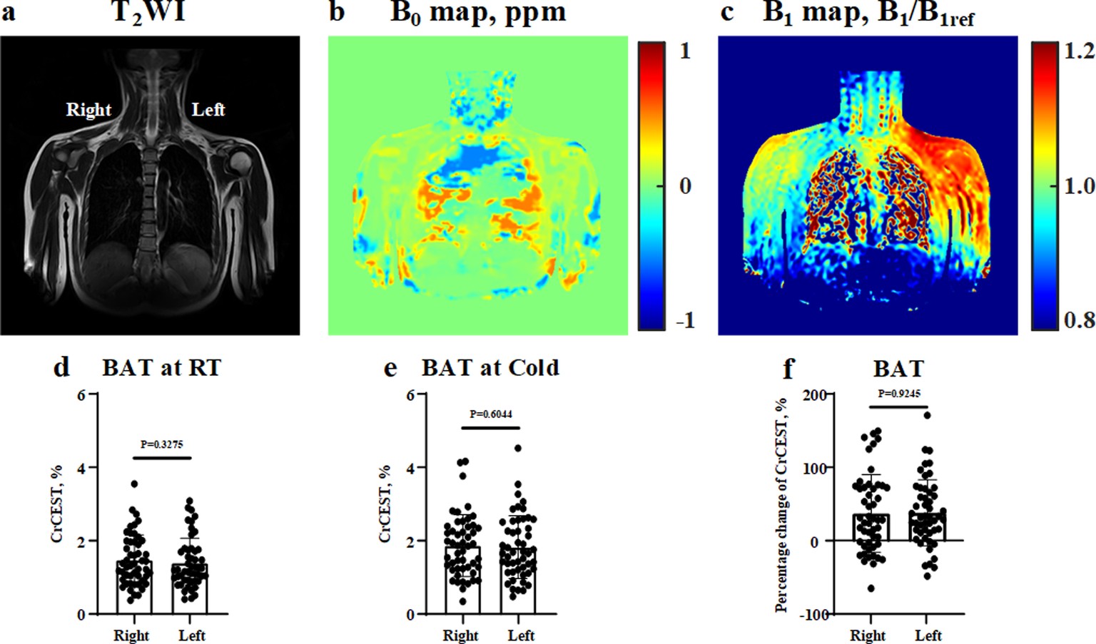 Extended Data Fig. 9: B0 and B1 inhomogeneity of human subjects did not affect the results of CrCEST MRI at 3T.